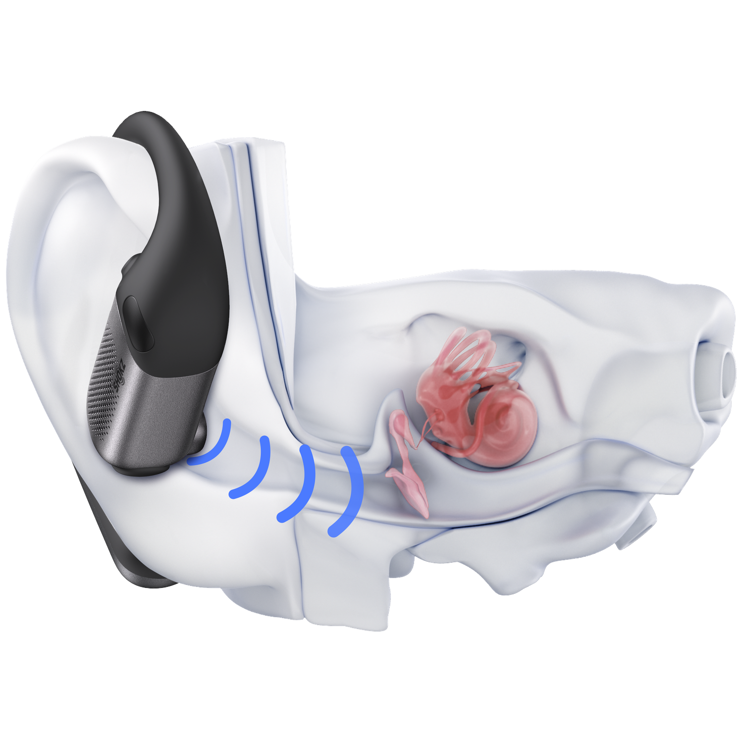 Anatomy of an ear showing an earbud, sound waves, and inner ear structures. The inner ear is red.