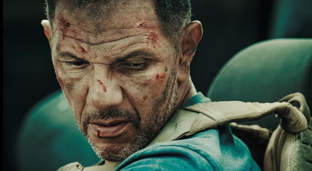 Ein Mann mit blauen Kleidern und Verletzungen im Gesicht schaut nach unten.