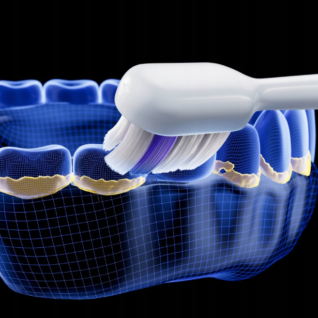 Elektryczna szczoteczka czyści niebieskie zęby 3D z żółtymi dziąsłami.