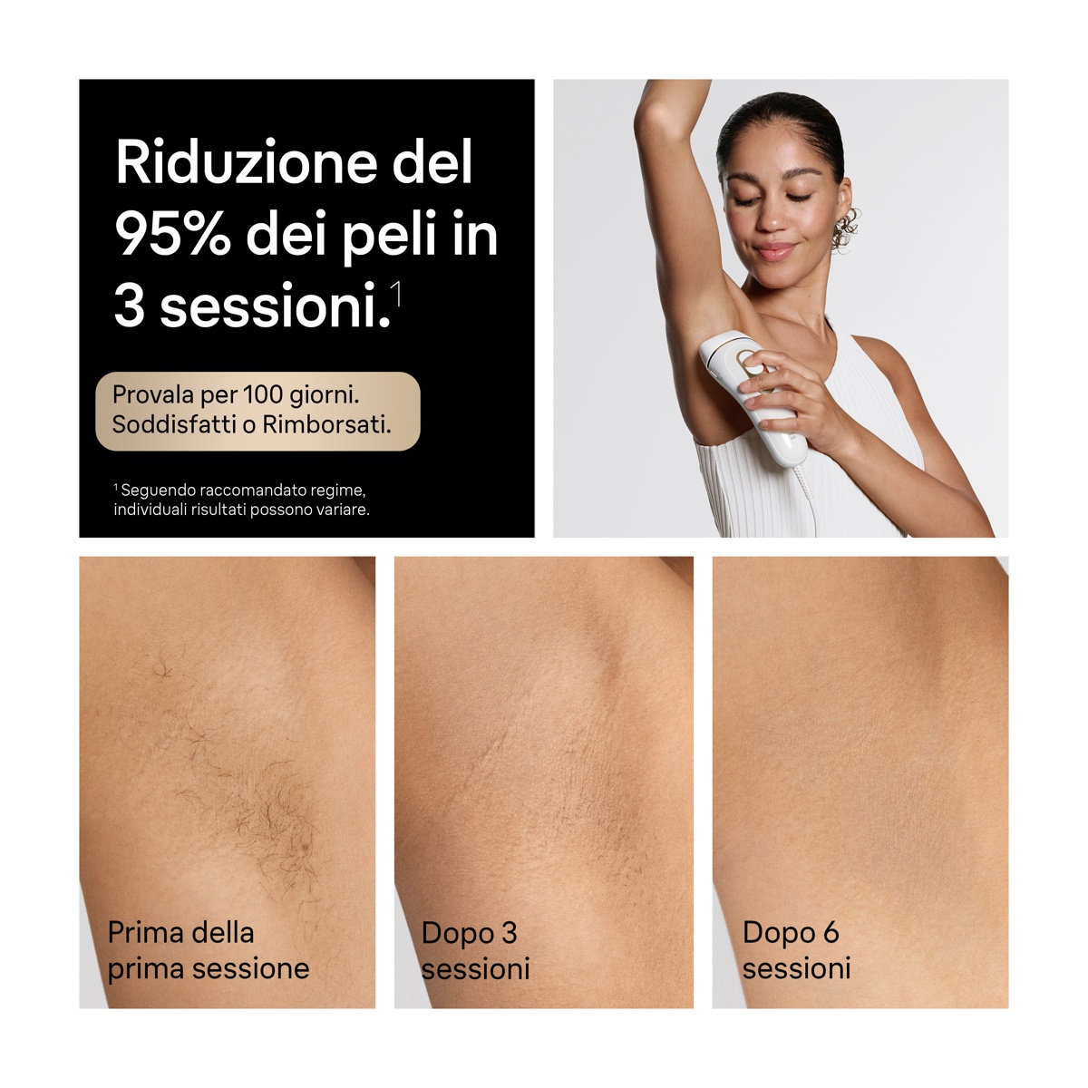 Donna usa epilatore IPL sul braccio. Immagini prima/dopo ascelle.