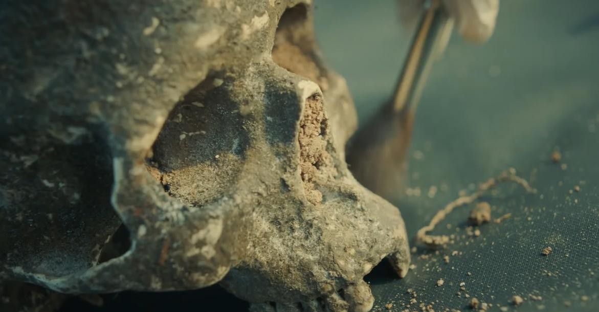 Detailaufnahme eines alten Schädels, der von Archäologen untersucht wird.