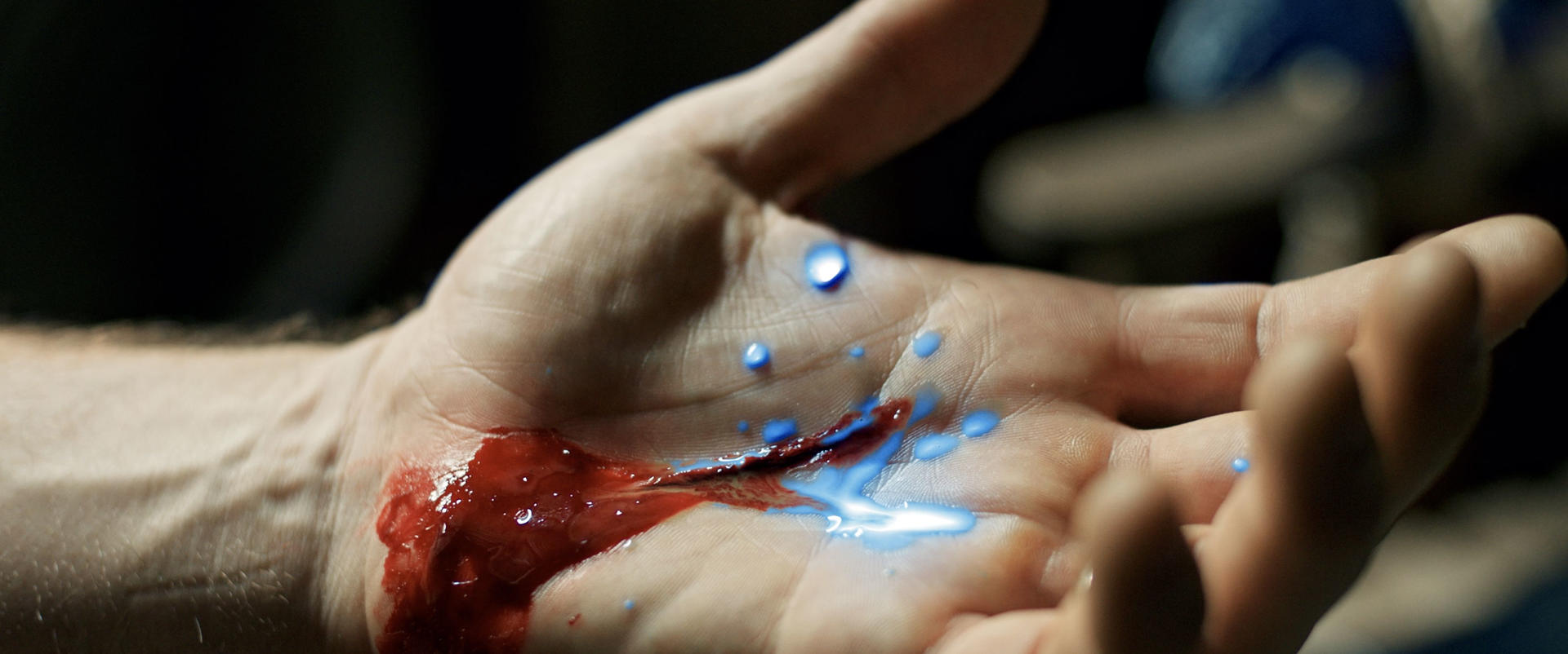Eine Hand mit einer blutigen Wunde und blauen Tropfen.