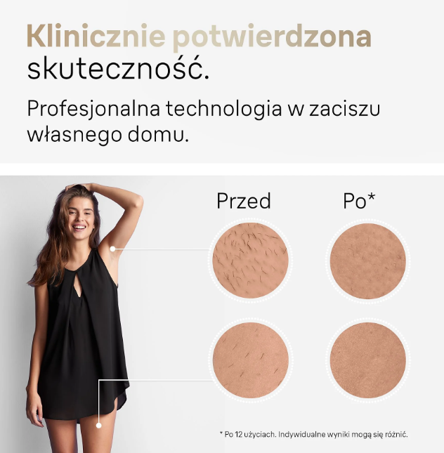 Kobieta prezentuje wyniki przed i po depilacji.