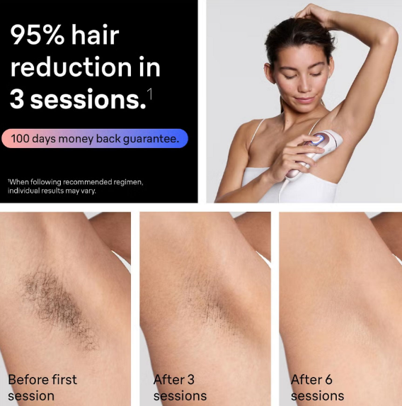 Kobieta używa depilatora IPL, włosy pod pachami przed/po zabiegu.