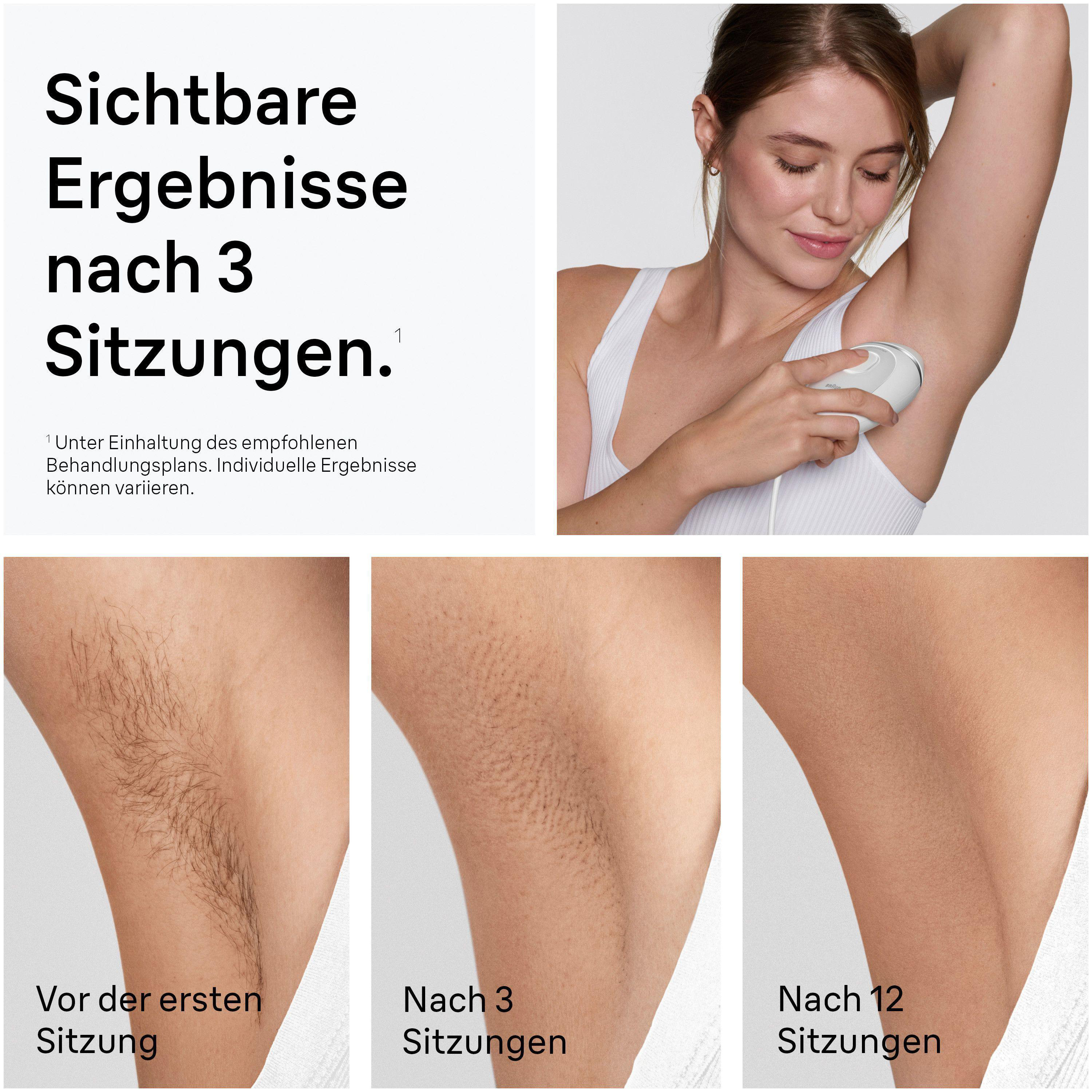 Frau benutzt Haarentfernungsgerät. Vorher/Nachher-Bilder der Achselhaare.