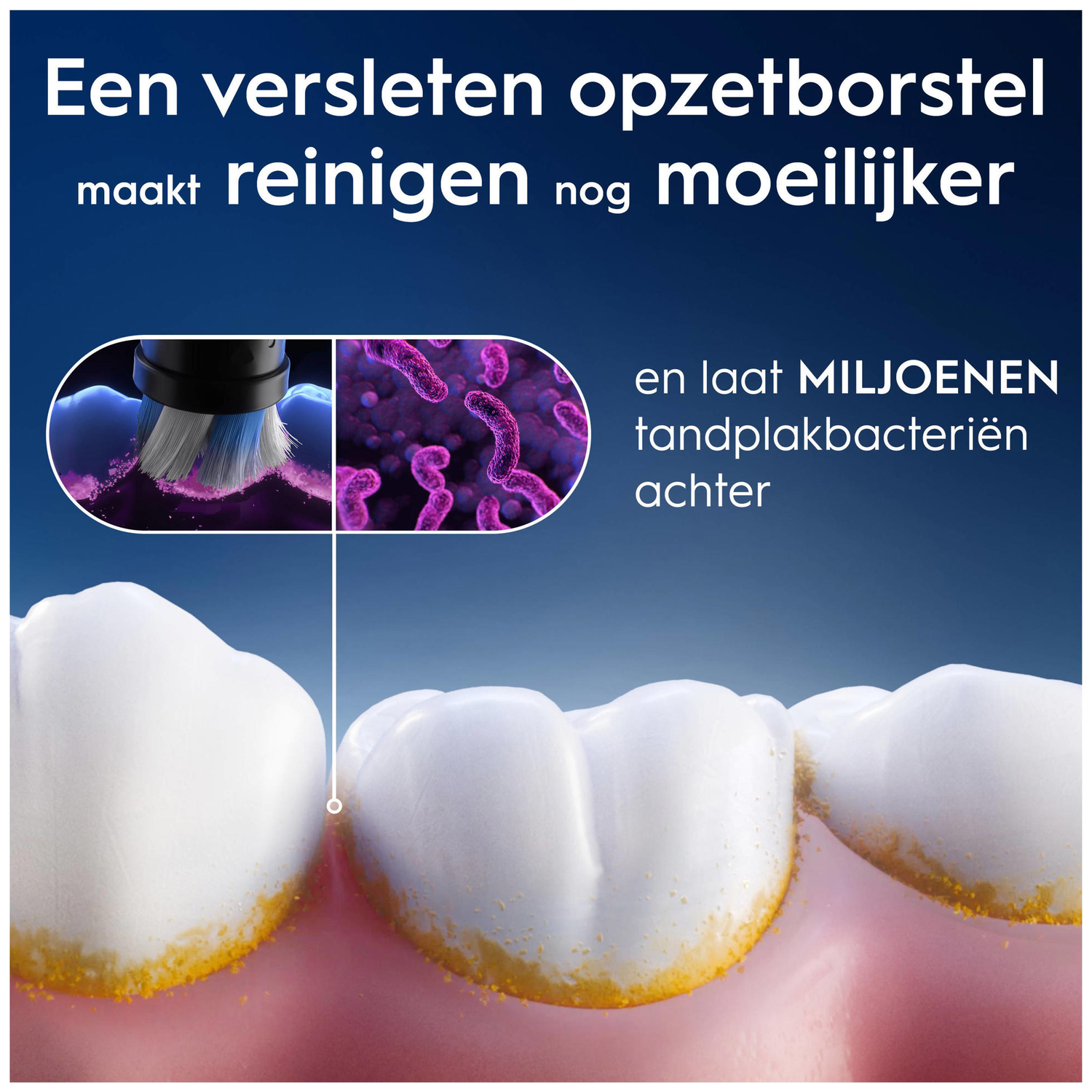 Worn toothbrush head cleans teeth poorly, leaving bacteria behind.