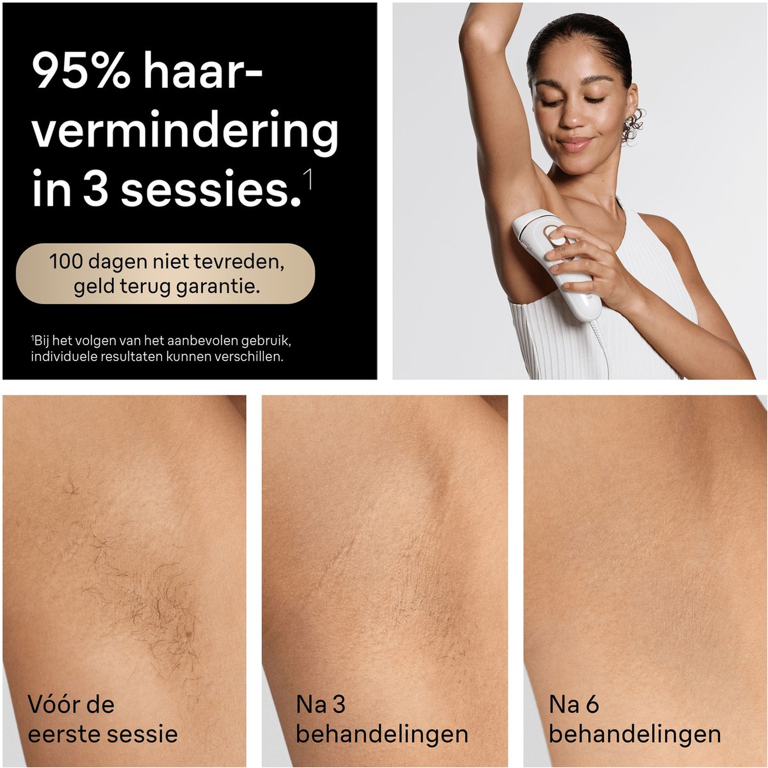 Woman uses IPL device on underarms; before & after images show hair reduction.
