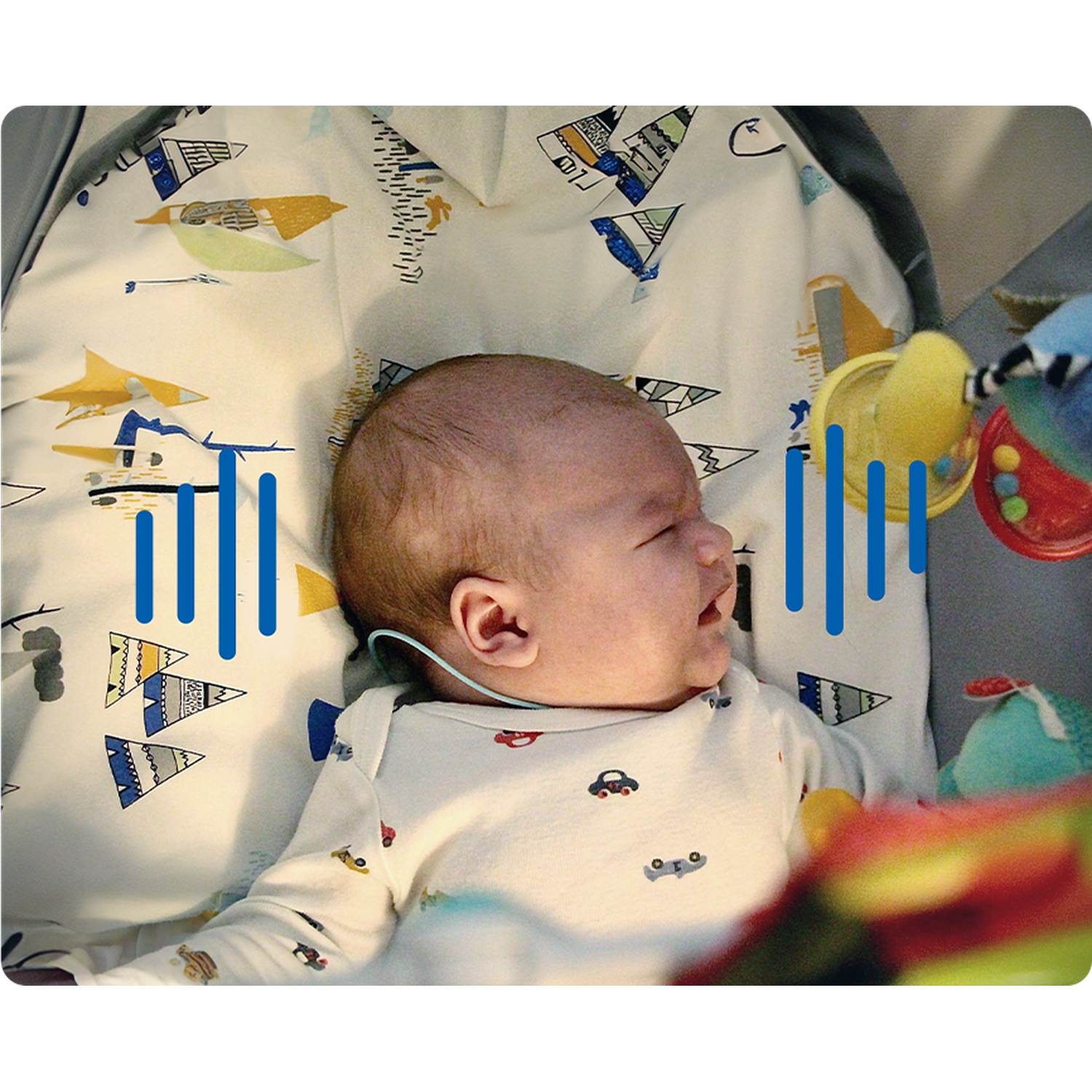 Een baby met gehoorapparaat ligt op een deken met patronen en speelgoed in de buurt.