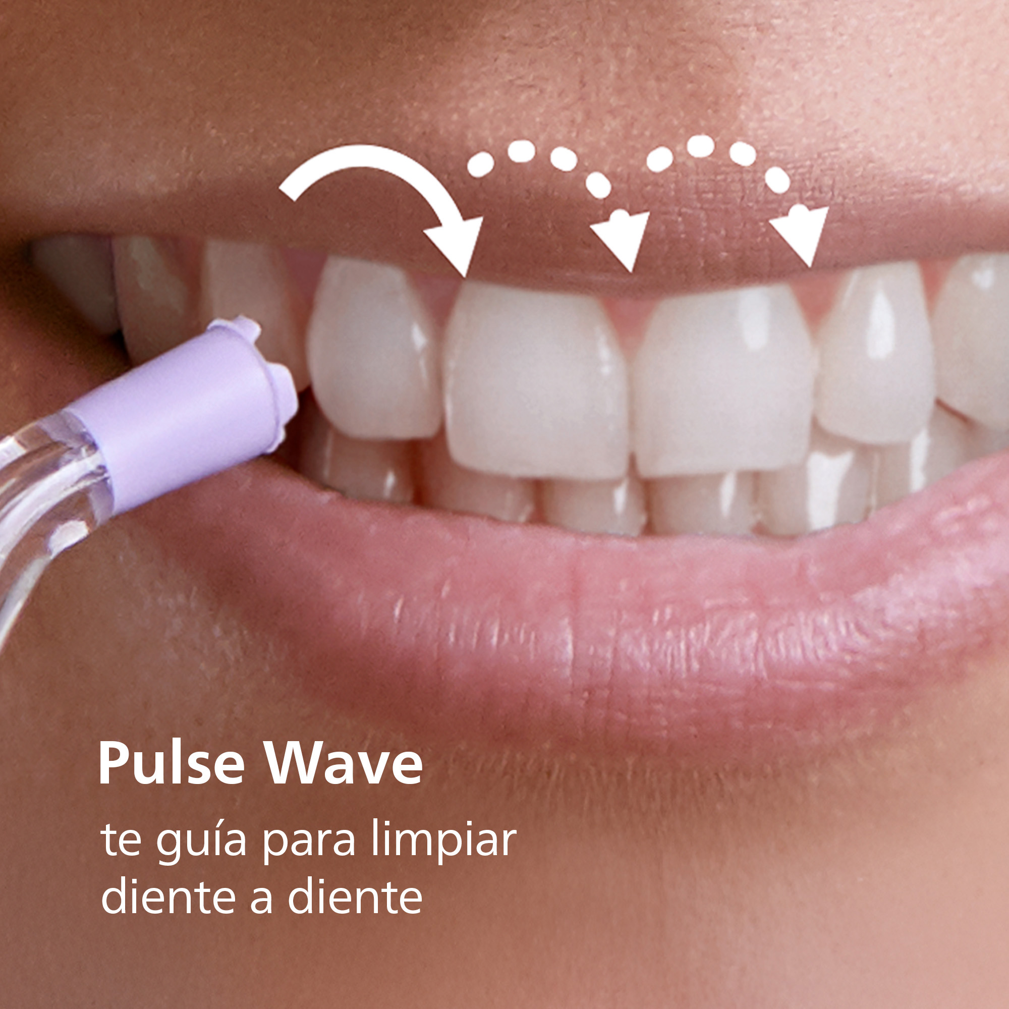 Una boca con dientes blancos, se usa un irrigador bucal morado.
