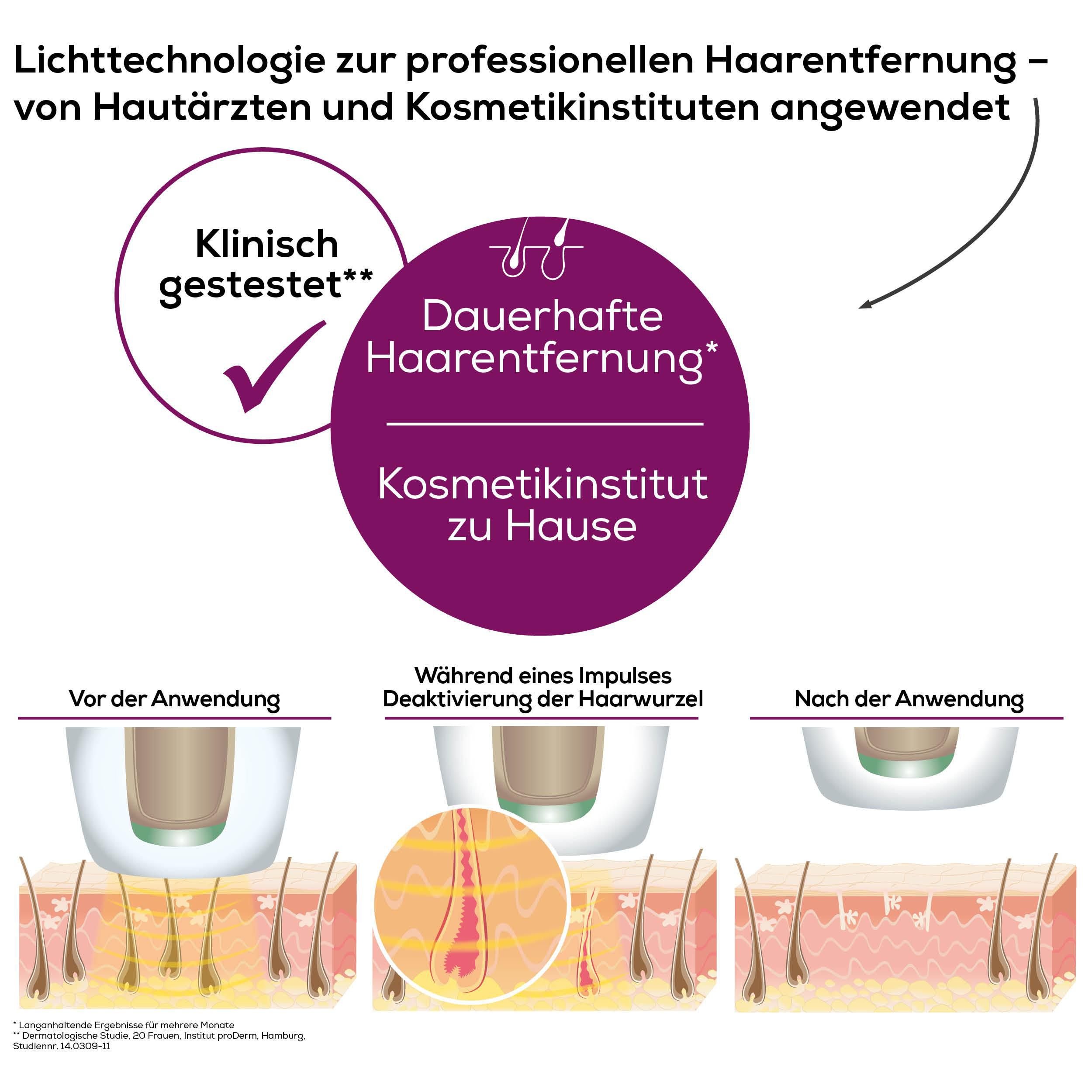 Illustration zeigt Lichttechnologie zur Haarentfernung vor, während und nach der Anwendung.