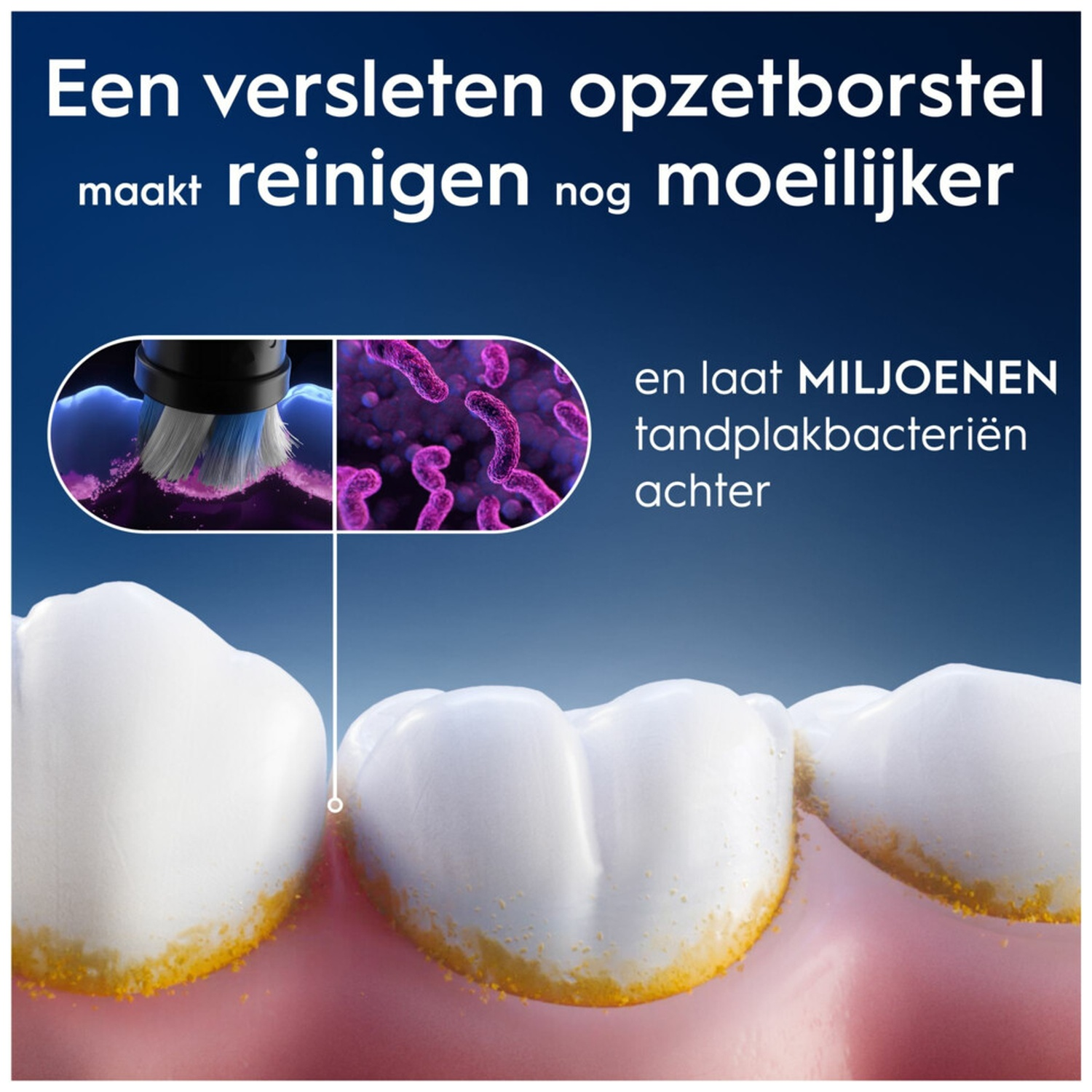 Worn brush head cleans poorly, leaving millions of bacteria behind.