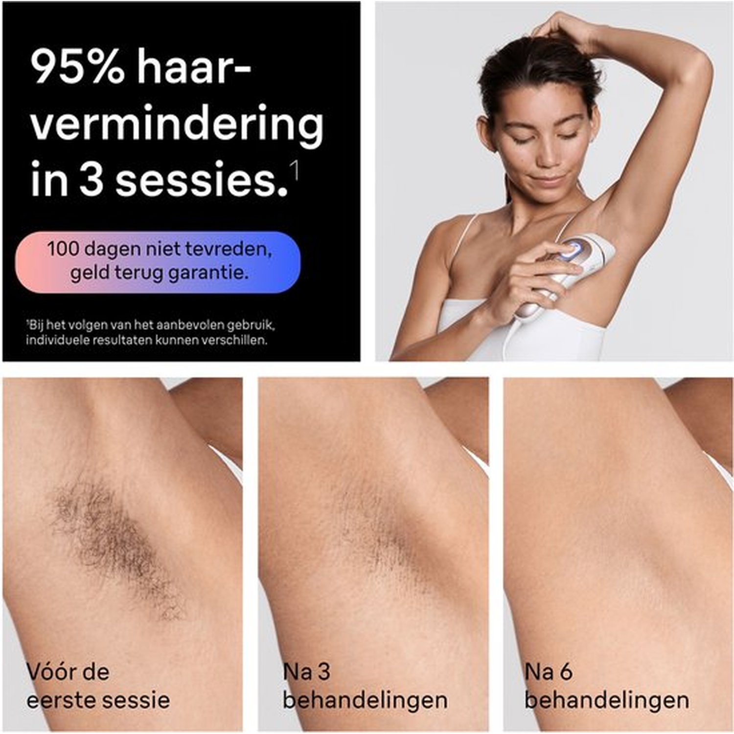 Vrouw gebruikt IPL-apparaat voor okselhaarverwijdering; voor/na foto's.