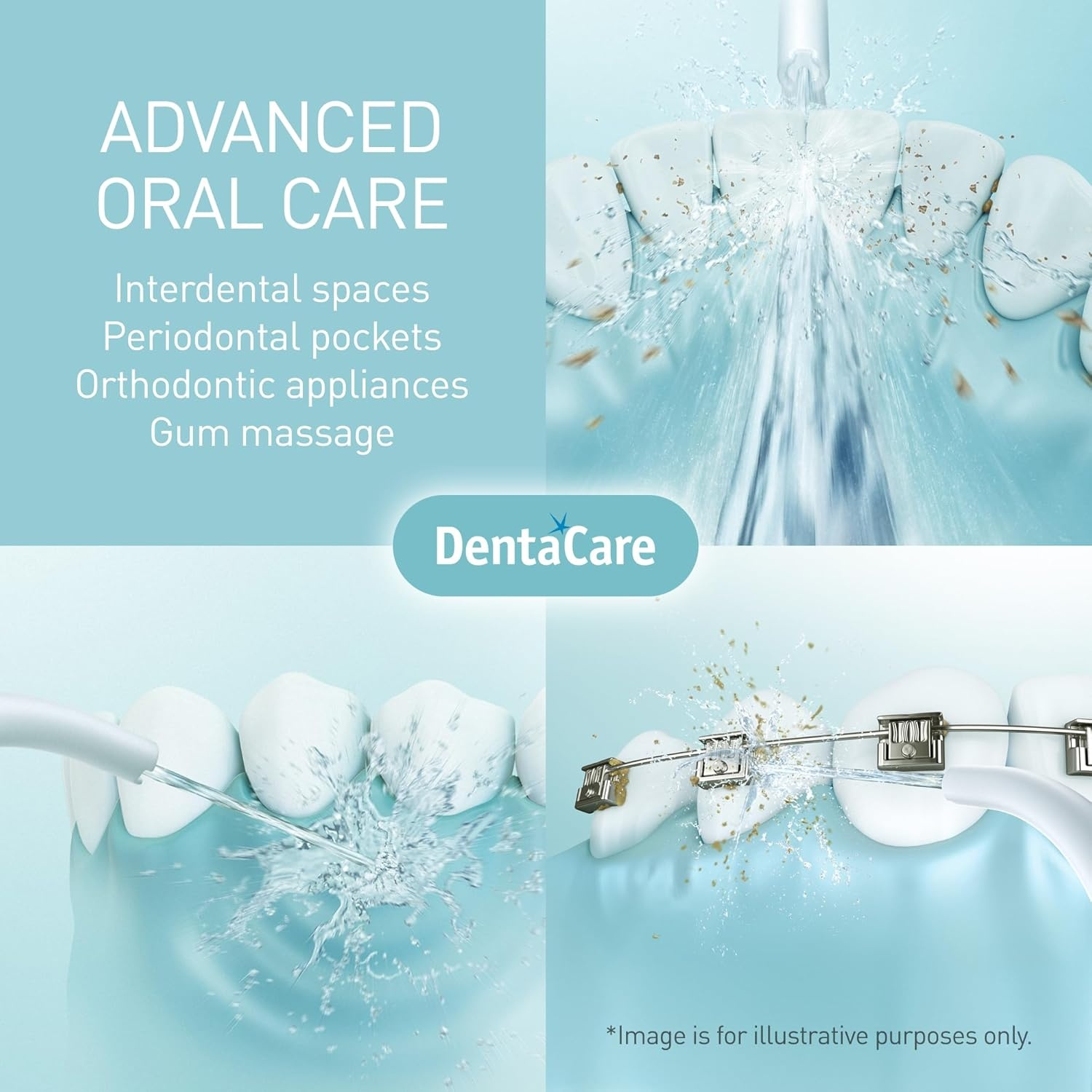Pulizia dentale con getto d'acqua: Denti, apparecchi ortodontici e gengive puliti.