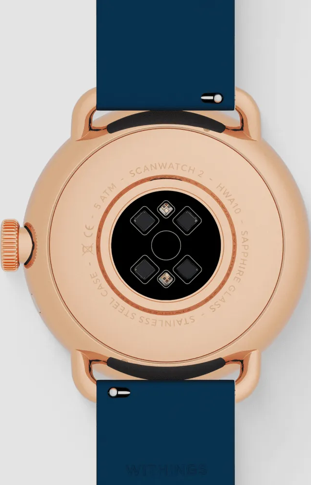 Die Rückseite einer rosegoldenen Smartwatch mit blauem Armband und Sensoren.