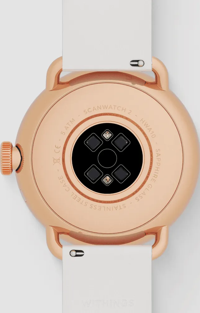 Rückseite einer goldenen Smartwatch mit weißem Armband. Sensoren in der Mitte.