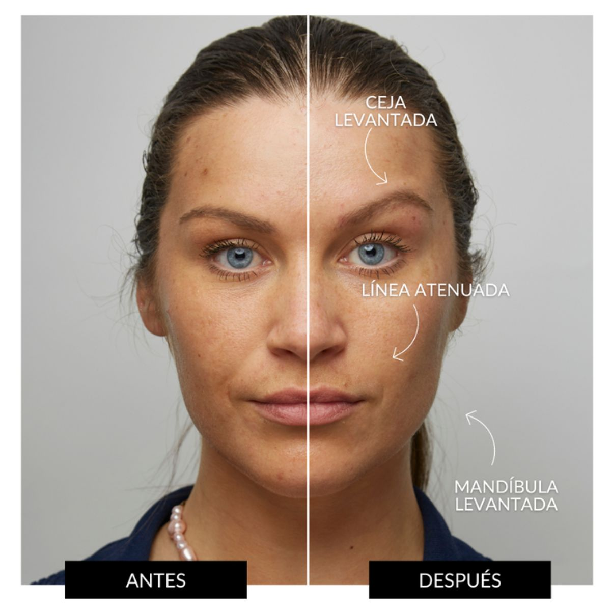 Imagen dividida de antes y después de la cara de una mujer, mostrando ceja levantada.