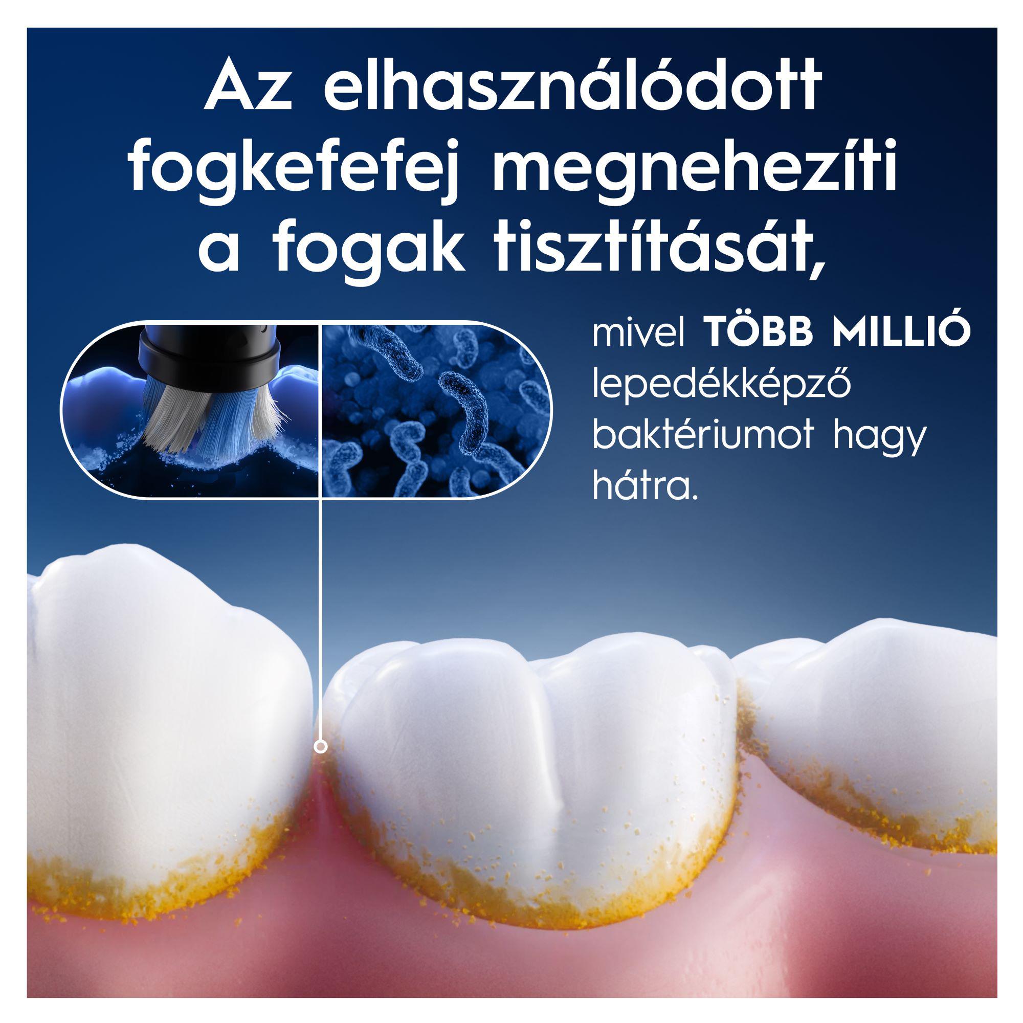 Az elhasználódott fogkefefej megnehezíti a fogtisztítást, millió lepedéket okozó baktériumot hagyva.