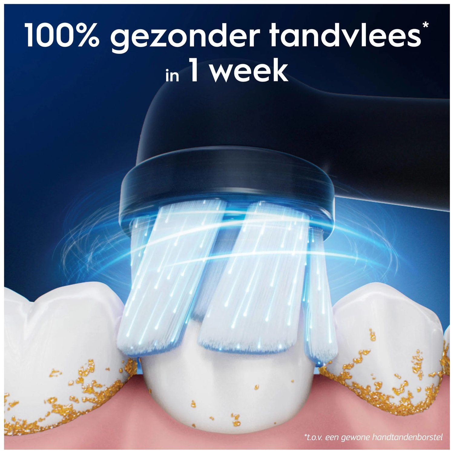 Electric toothbrush cleans teeth with yellow plaque buildup.