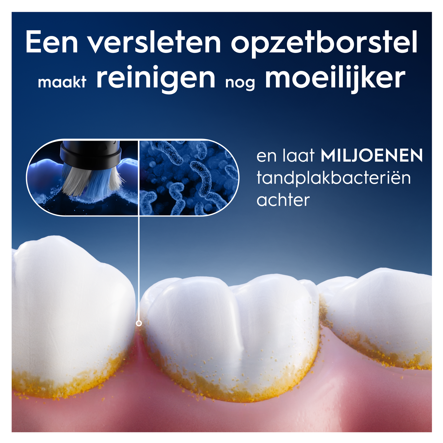 A worn toothbrush head and bacteria on teeth indicate difficult cleaning.