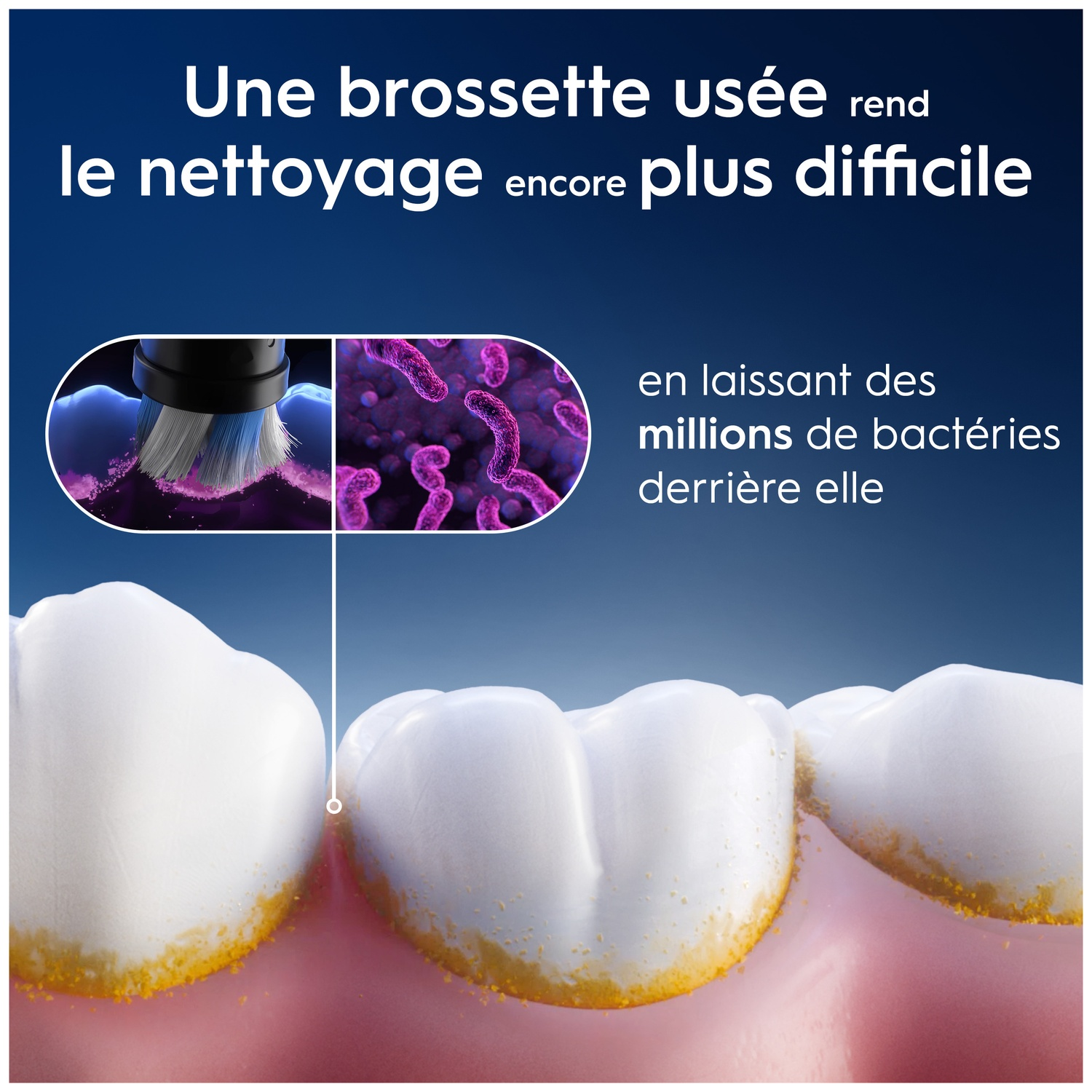Brosse usée rend le nettoyage difficile, laissant des millions de bactéries.