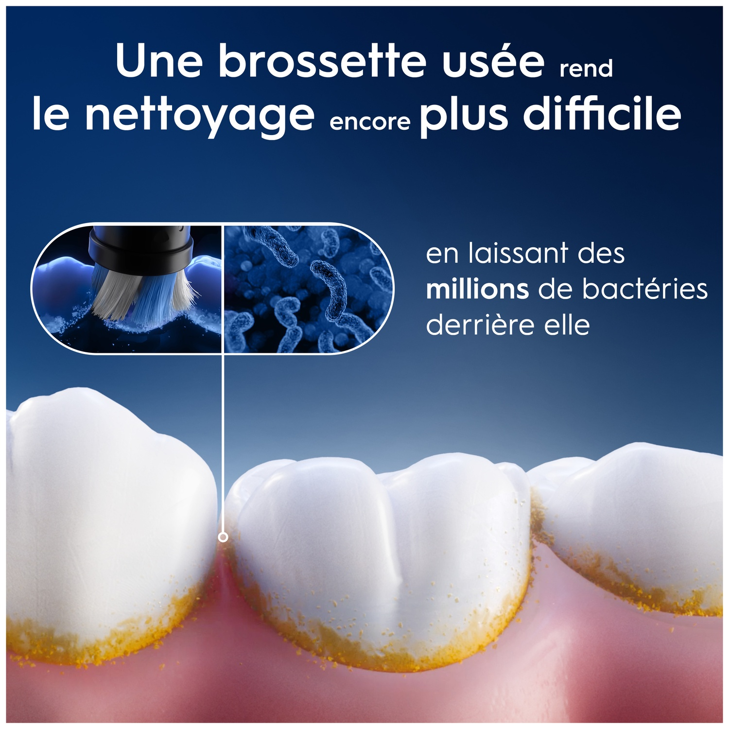 Brosse usée laisse millions de bactéries. Gros plan sur des dents avec plaque.