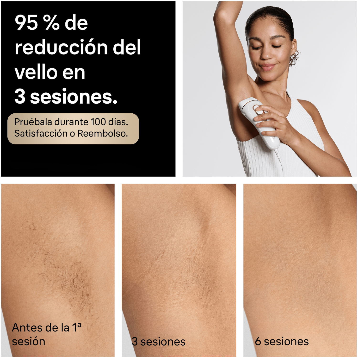 95% de reducción del vello en 3 sesiones.Pruébala durante 100 días. Satisfacción o reembolso. Antes de la 1ª sesión. 3 sesiones. 6 sesiones