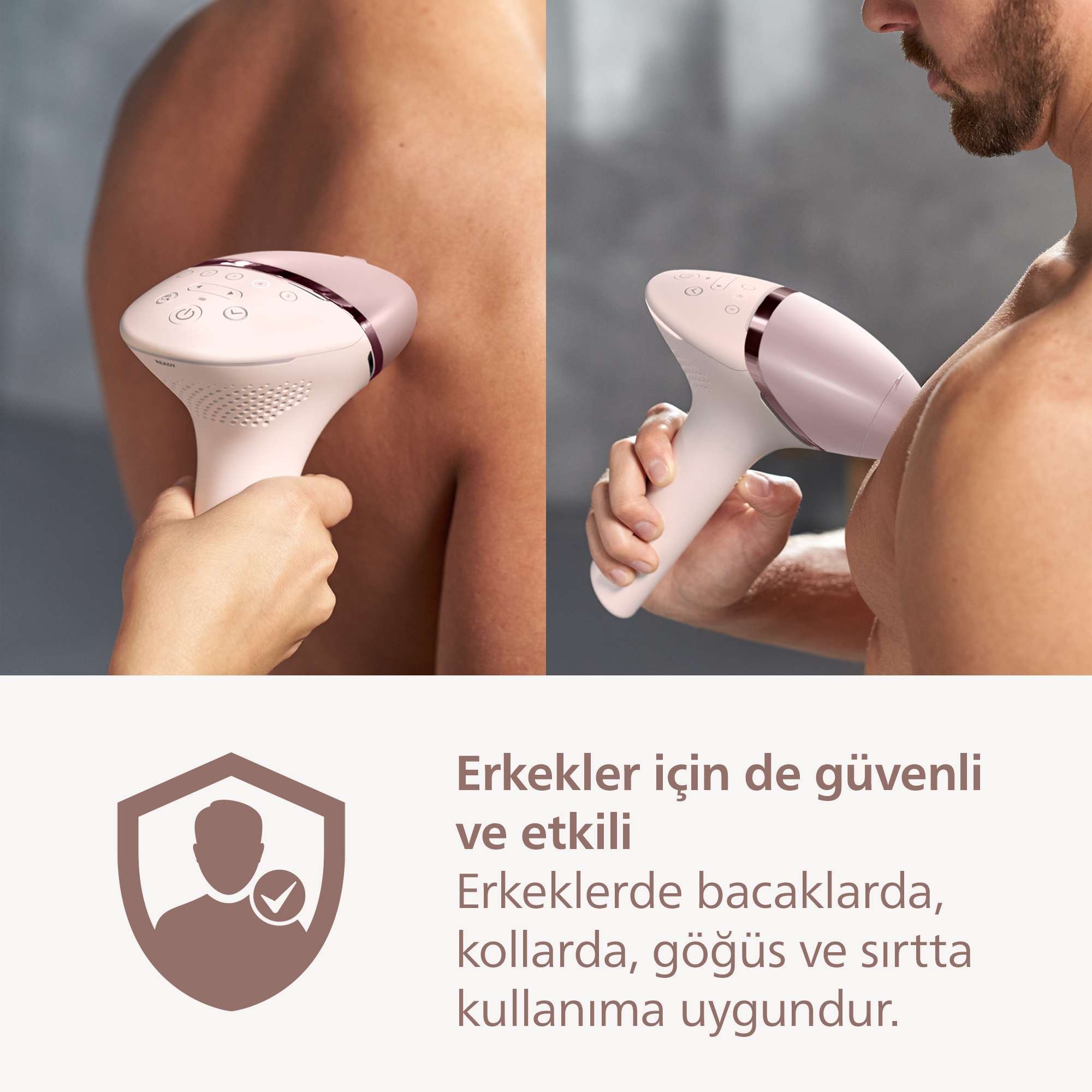Bir IPL cihazı bir erkeğin cildinde kullanılıyor.