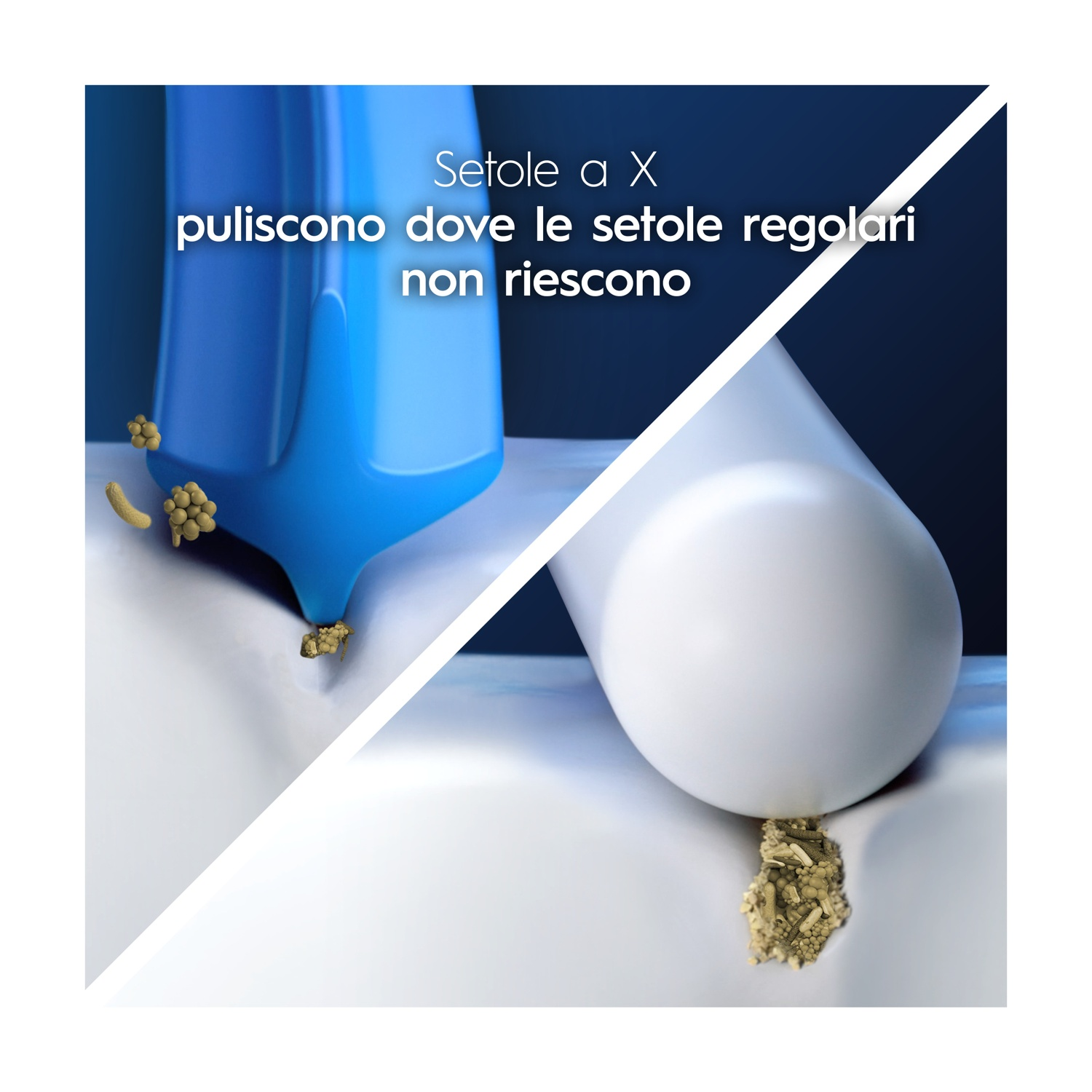 Testine spazzolino blu e bianche con batteri. Setole a X puliscono efficacemente.