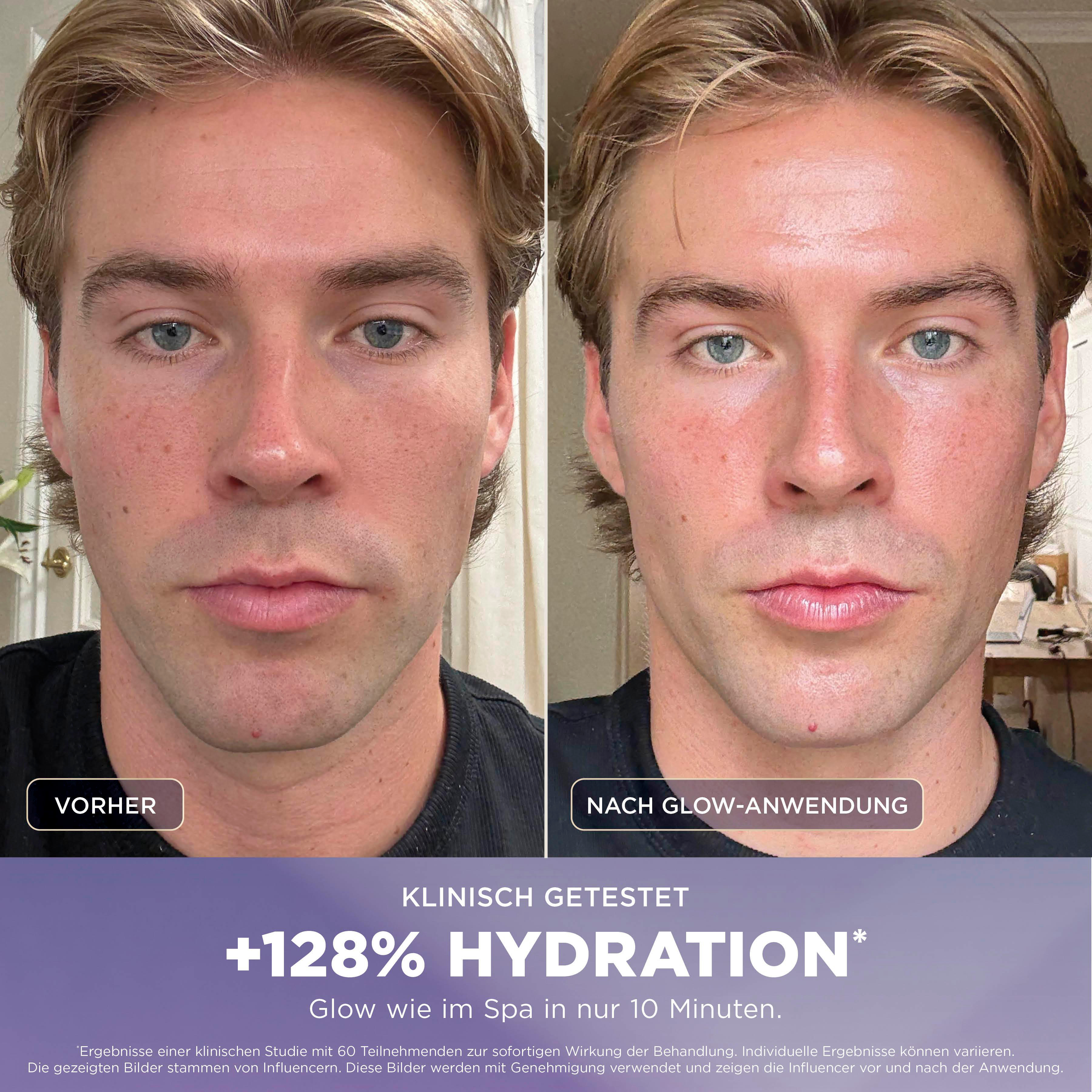 Vorher/Nachher-Vergleich eines Mannes, der +128% Hydration zeigt.