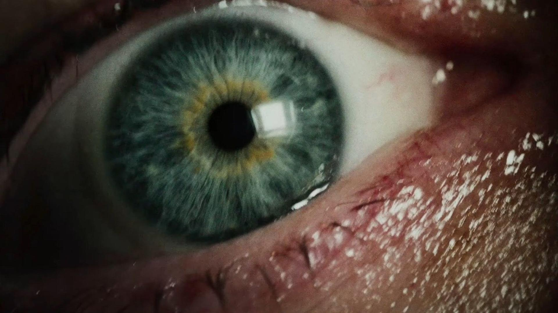 Nahaufnahme eines menschlichen Auges mit blauer Iris und sichtbarer Aderhaut.