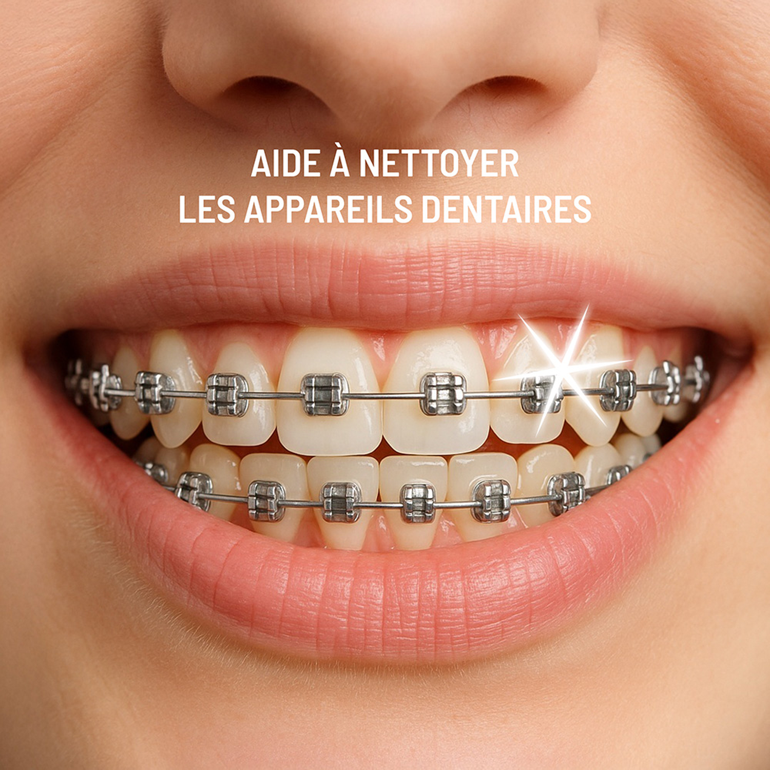 Close-up of teeth with braces and a sparkling star symbol.