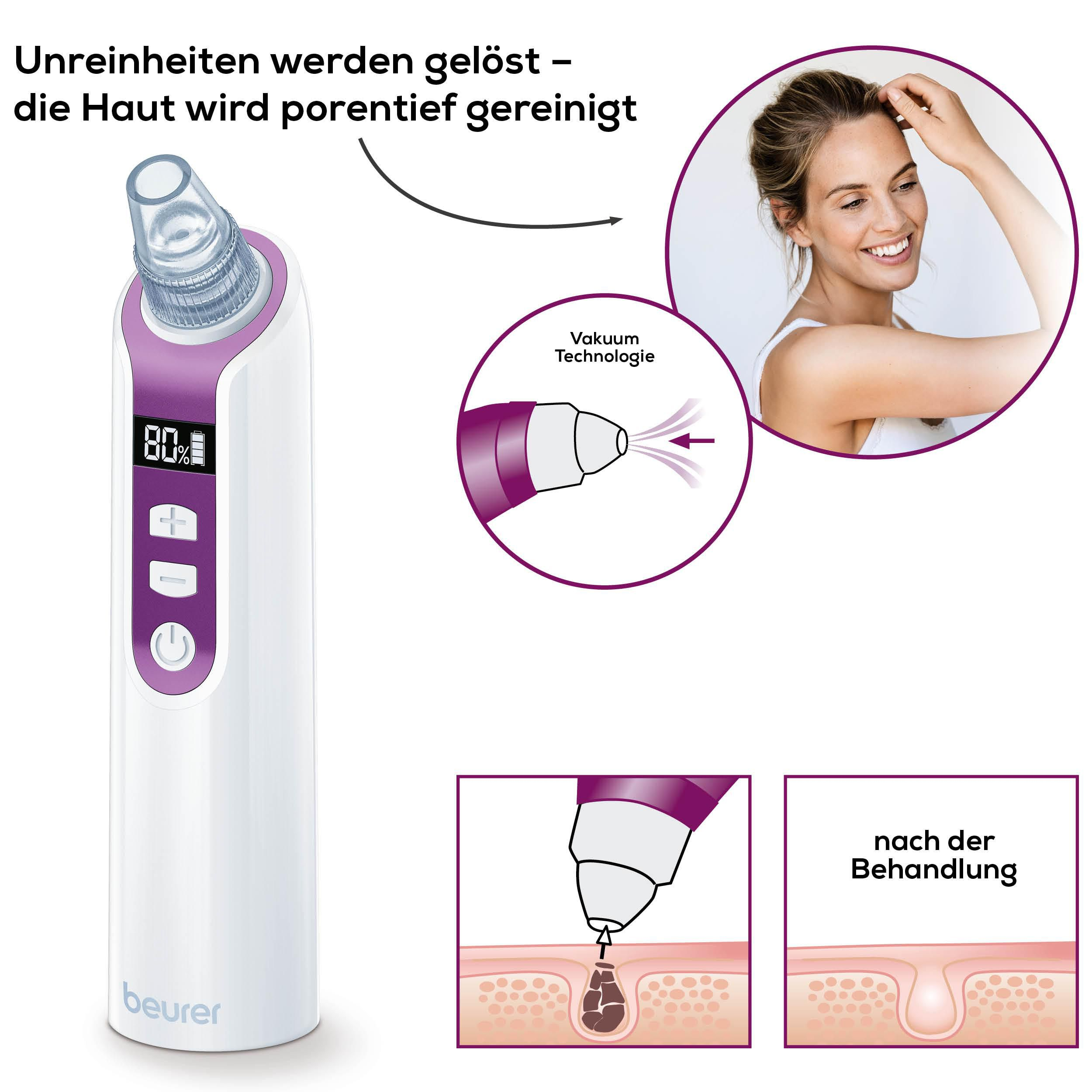 Beurer Hautreiniger mit Vakuumtechnologie für porentiefe Reinigung.