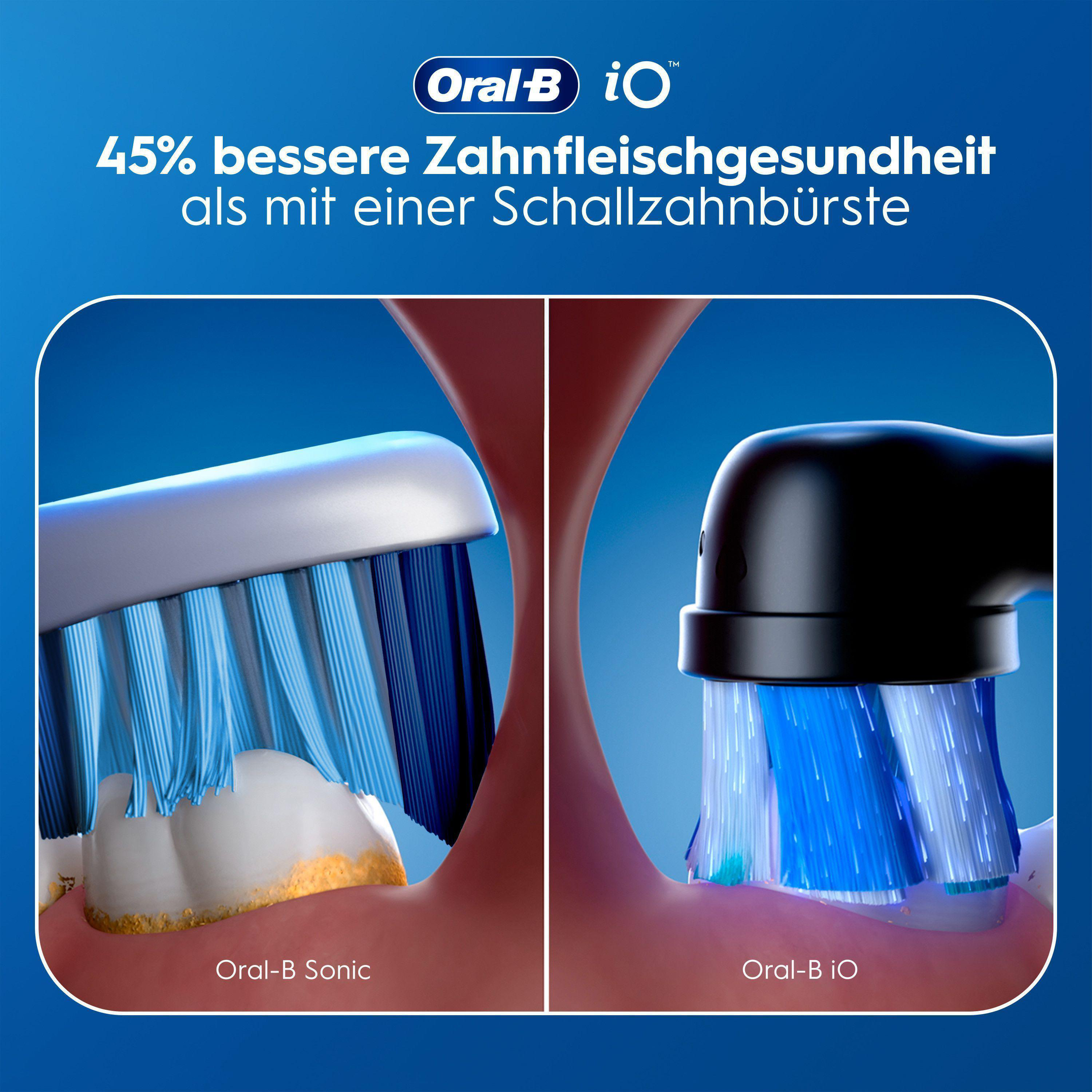 Vergleich von Oral-B iO und Sonic Zahnbürsten am Zahnfleisch.
