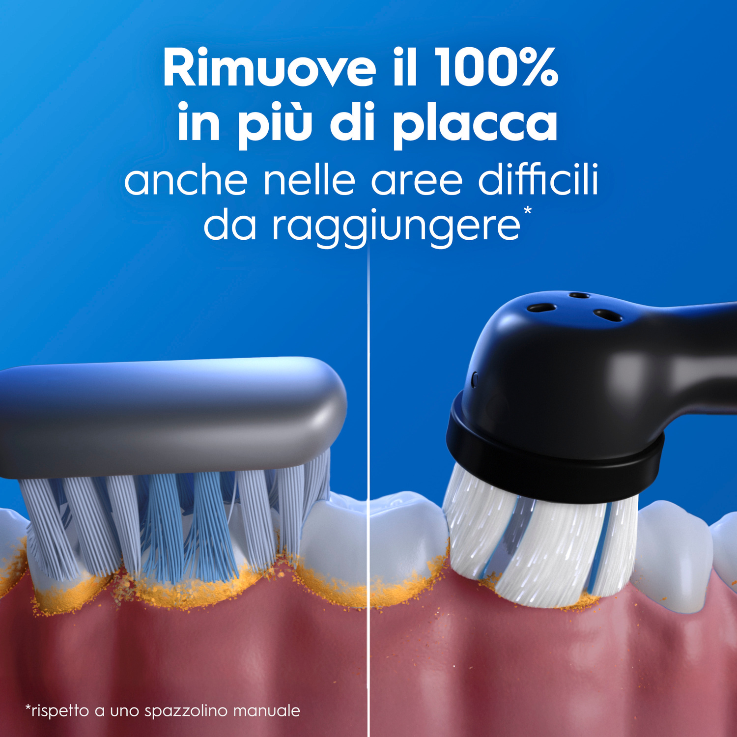 Testina elettrica pulisce denti e gengive, rimuovendo placca.