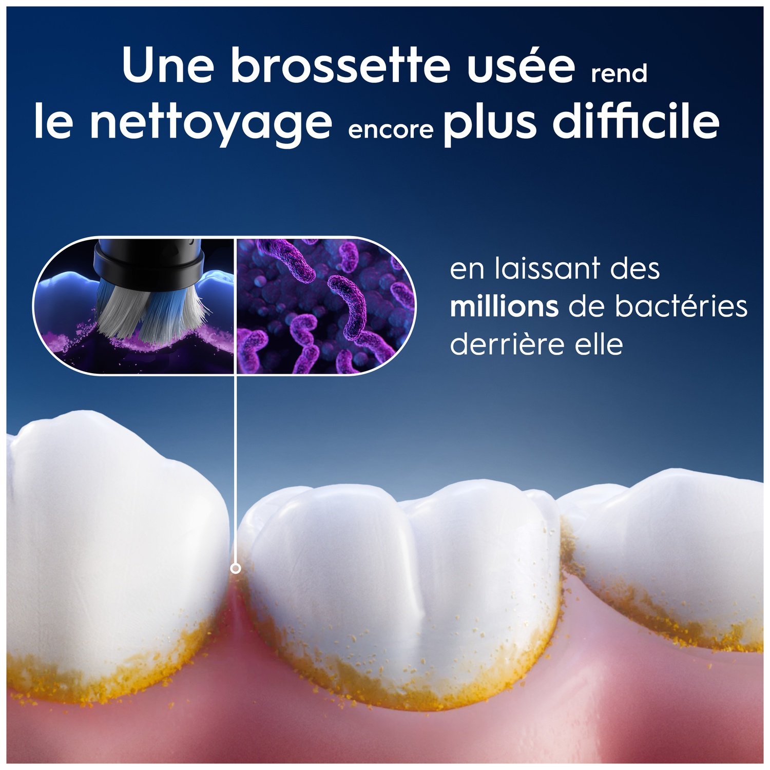 Une brosse usée rend le nettoyage difficile, laissant des millions de bactéries.