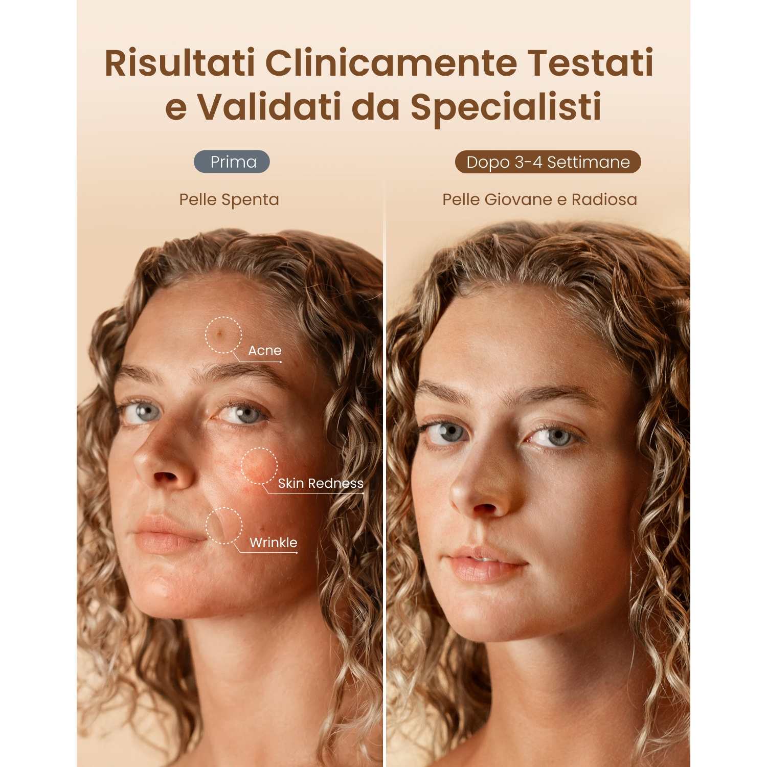 Prima/dopo: Pelle con acne, rossori, rughe diventa giovane e radiosa.