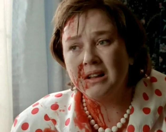 Eine Frau mit blutverschmiertem Gesicht und einem gepunkteten Kleid weint.
