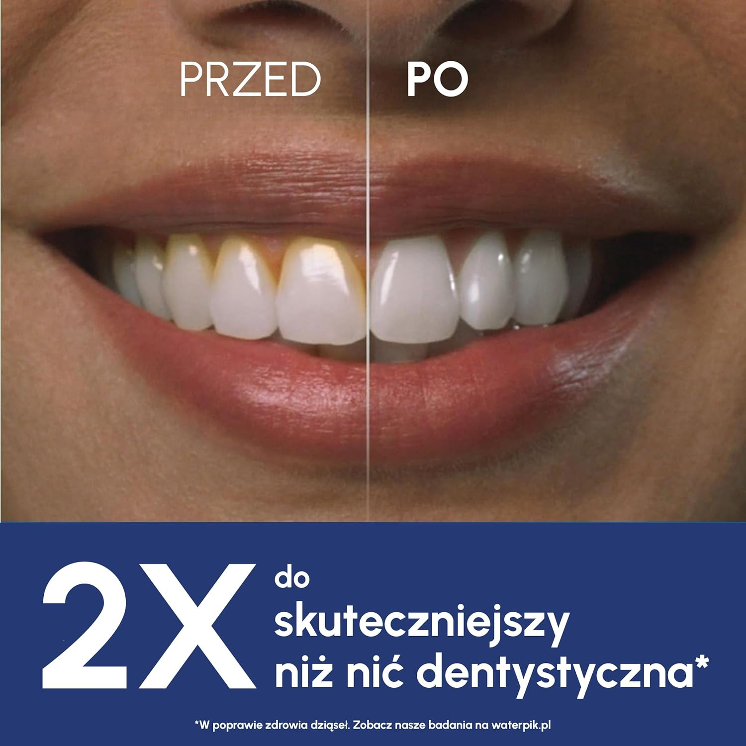 Porównanie zębów i dziąseł przed i po. 2x skuteczniejszy niż nić dentystyczna.