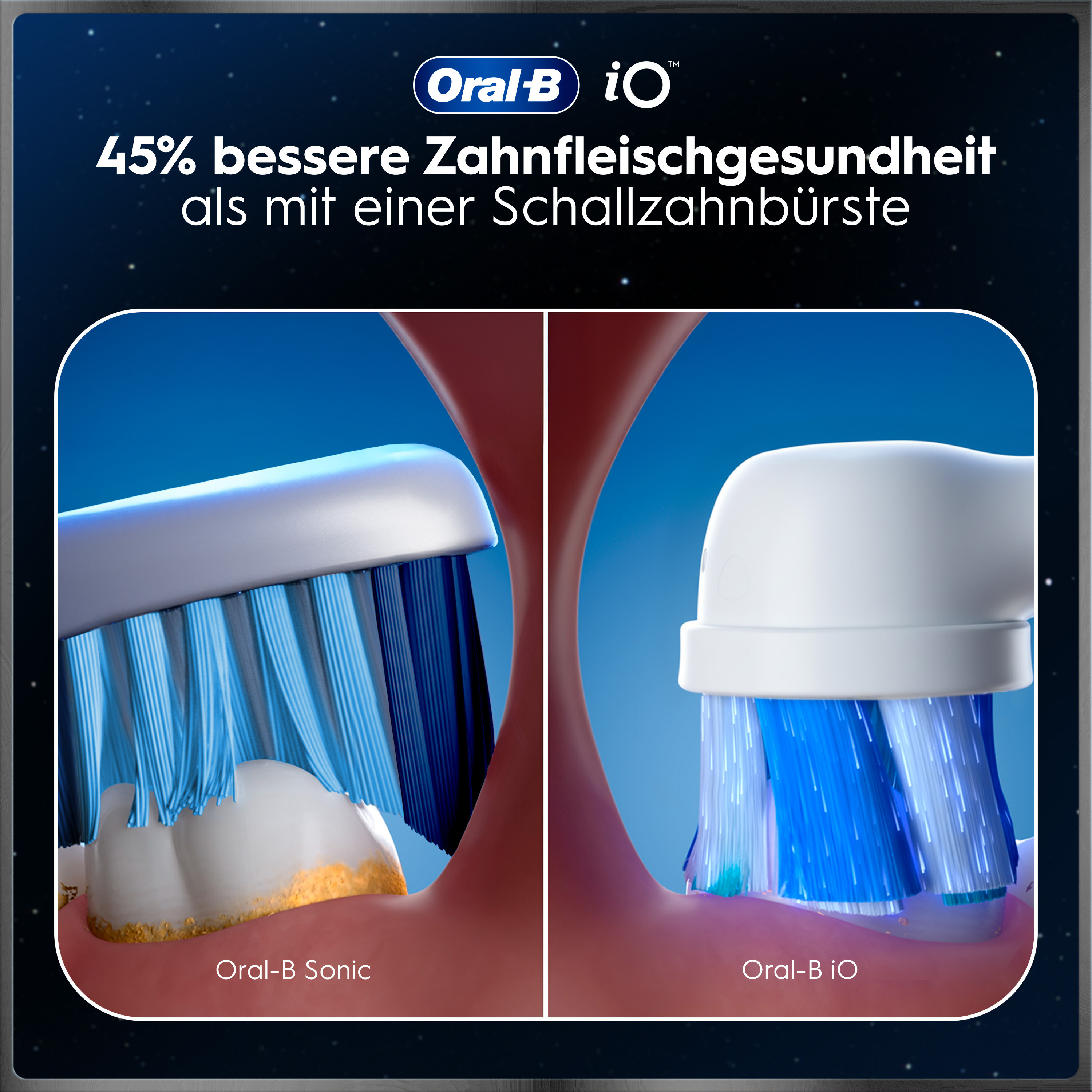 Deux têtes de brosse à dents sont comparées : "Oral-B Sonic" et "Oral-B iO".