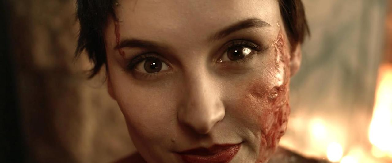 Nahaufnahme einer kurzhaarigen Frau mit schweren Narben und Make-up im Gesicht, die direkt in die Kamera blickt.