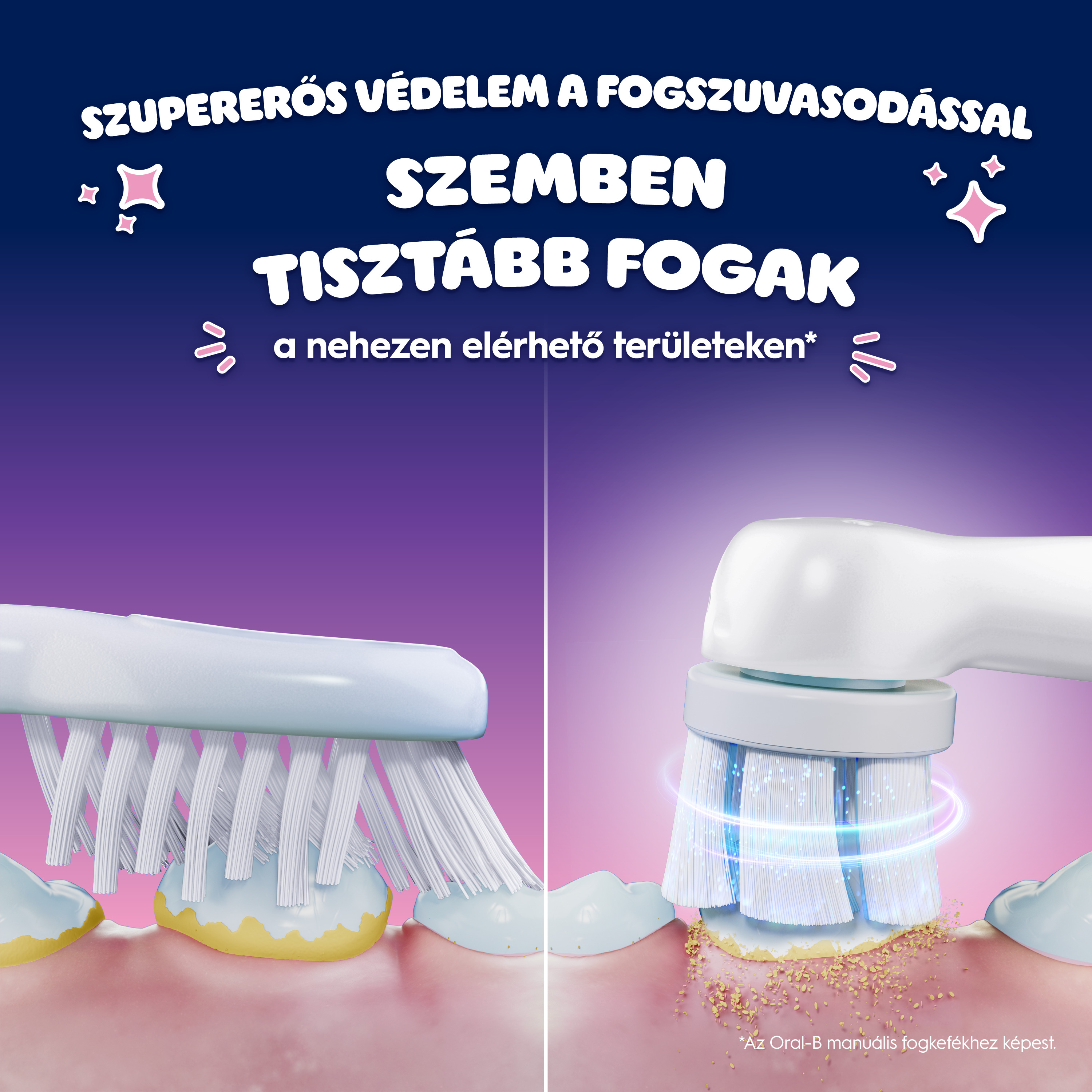Manuális fogkefe lepedékkel és elektromos fogkefe, ami eltávolítja azt.