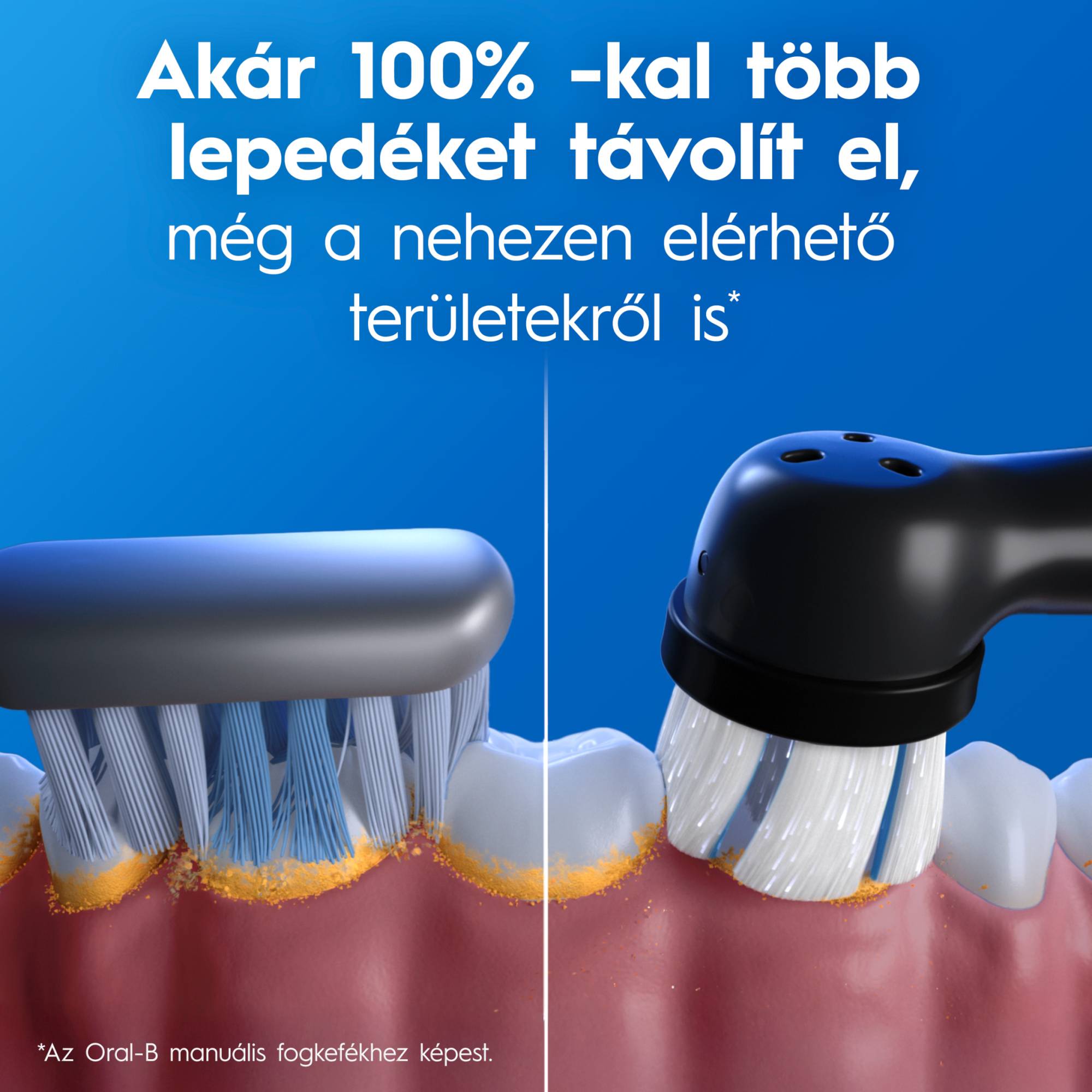 Manuális és kör alakú fogkefe összehasonlítása lepedékeltávolítás közben a fogakon.