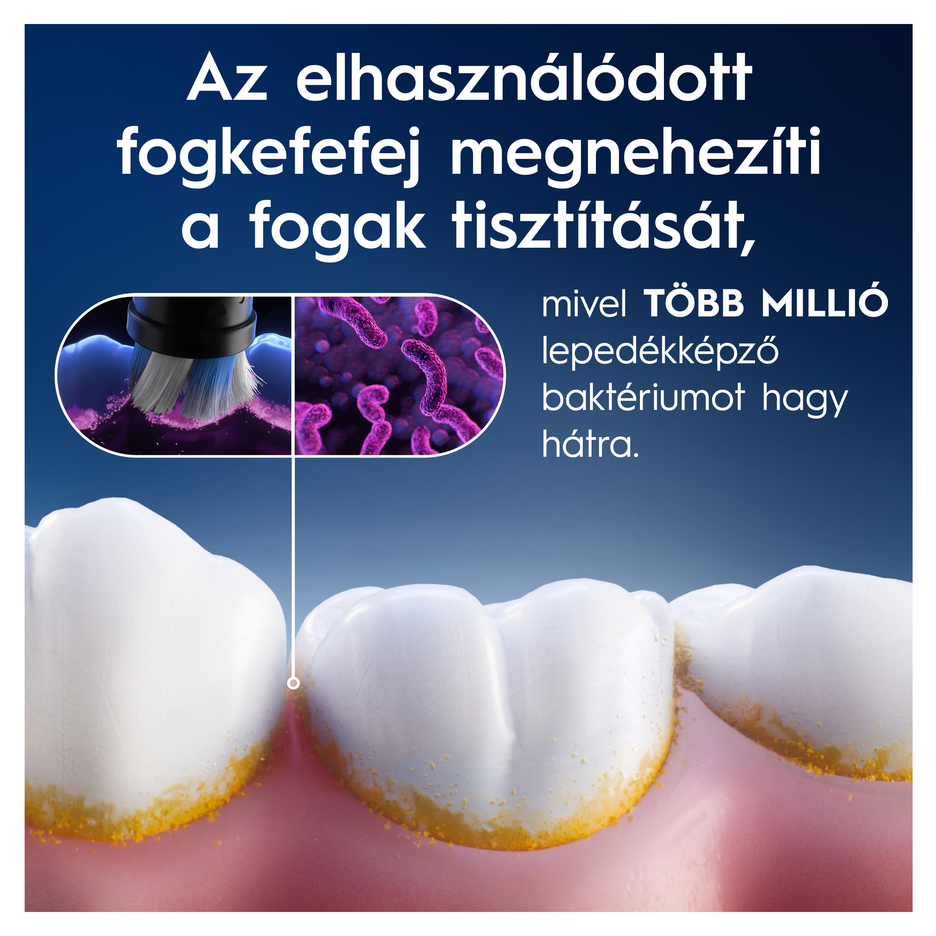 Közelkép sárga lepedékes fogakról, felette magyar nyelvű tájékoztató szöveggel.