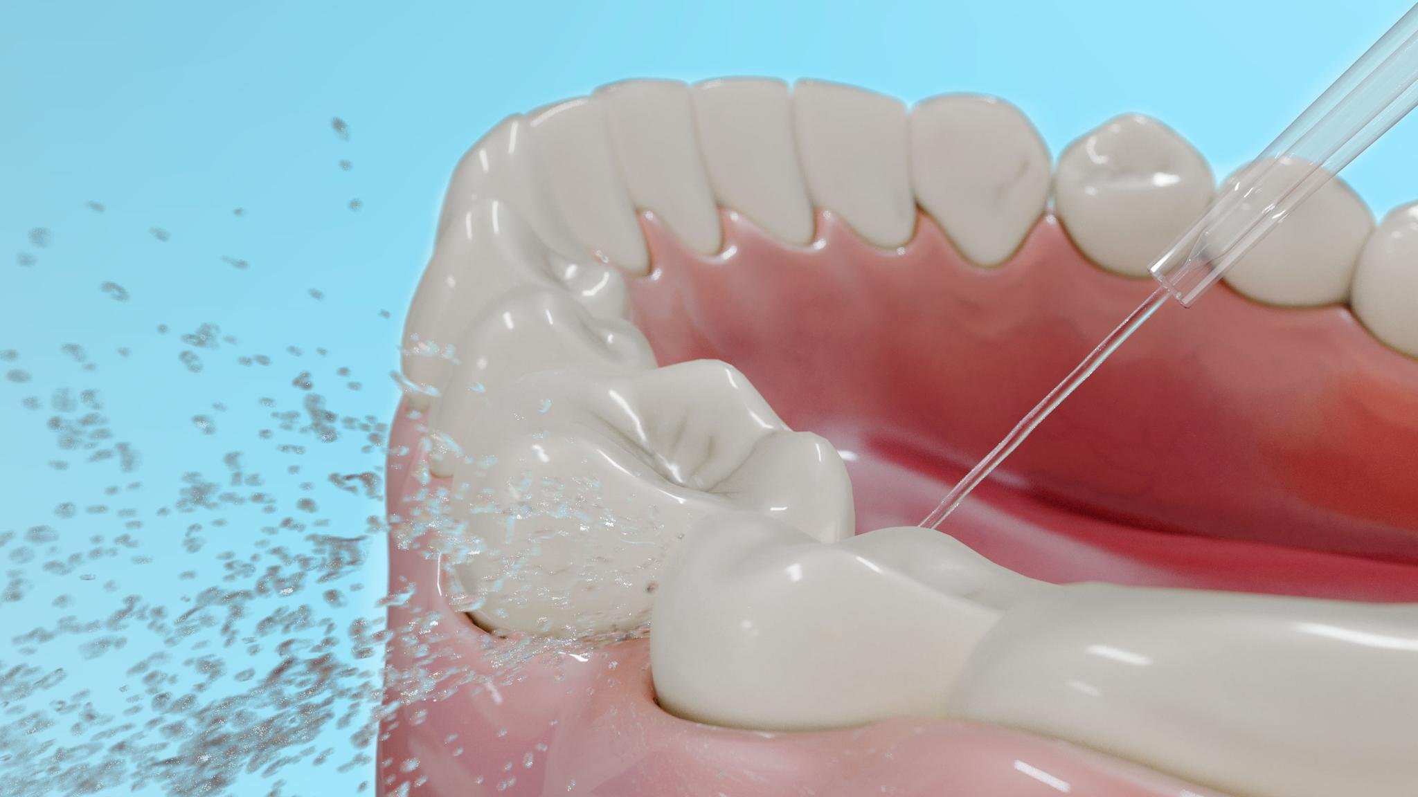 Un modelo dental muestra dientes blancos, encías rosas, un chorro de agua y salpicaduras sobre un fondo azul.