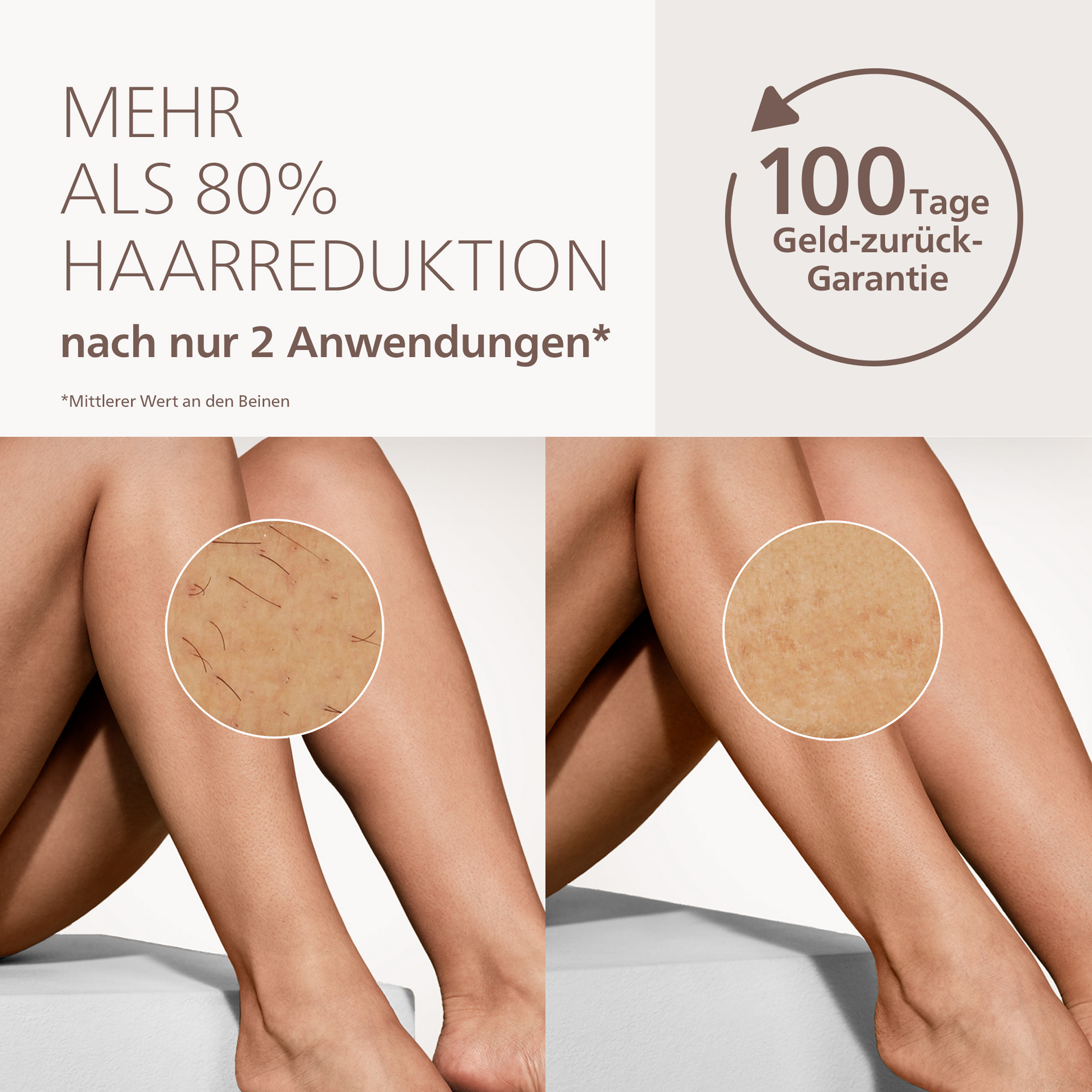 Werbung für Haarentfernung mit vorher-nachher-Vergleich der Haut.