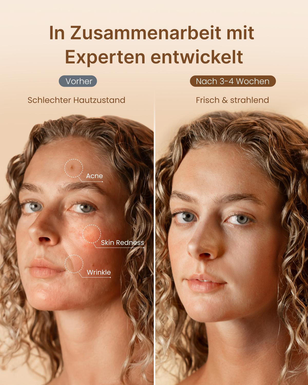 Vergleichsbilder einer Frau vor und nach Hautpflegebehandlung mit sichtbarer Verbesserung.