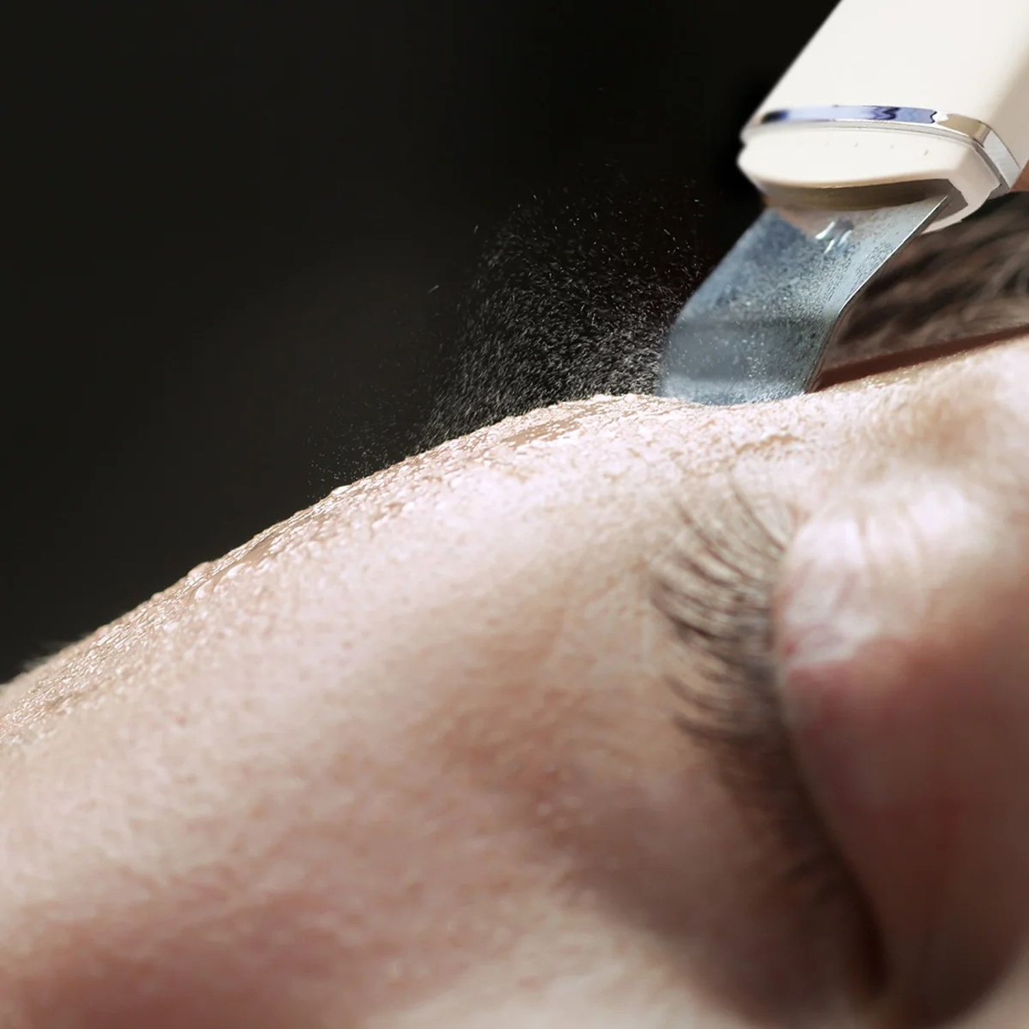 Uno scrubber a ultrasuoni deterge la pelle del viso, producendo una sottile nebbia d'acqua.