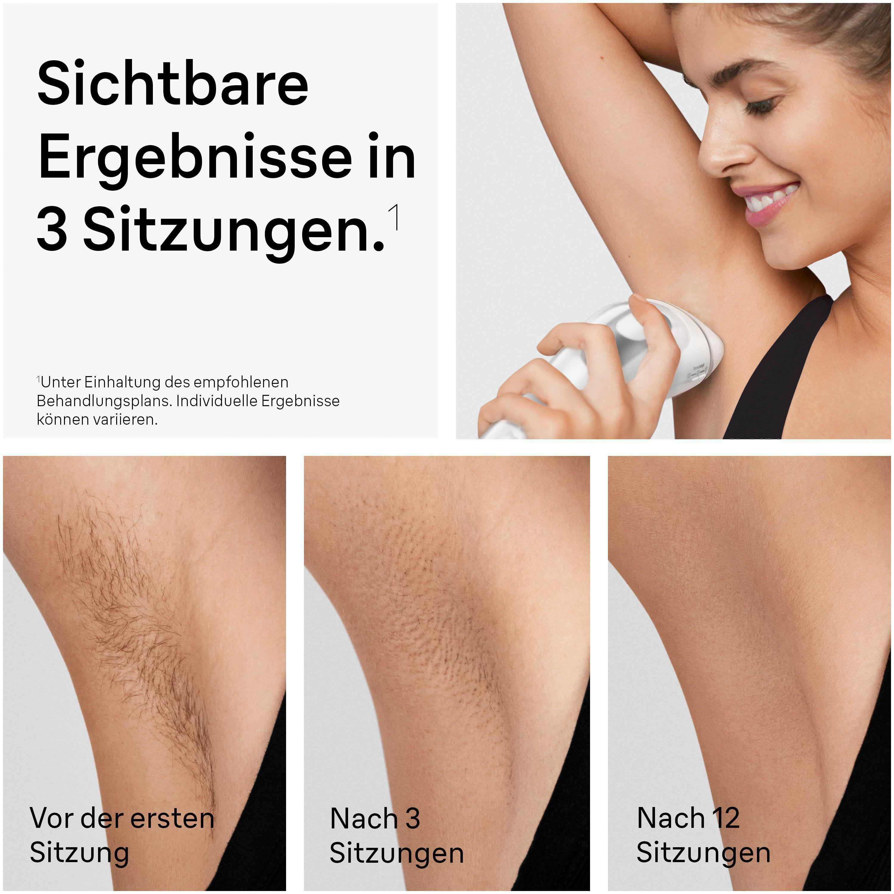 Eine Frau nutzt ein IPL-Gerät unter dem Arm. Drei Bilder zeigen haararme Haut vor, während und nach der Behandlung.