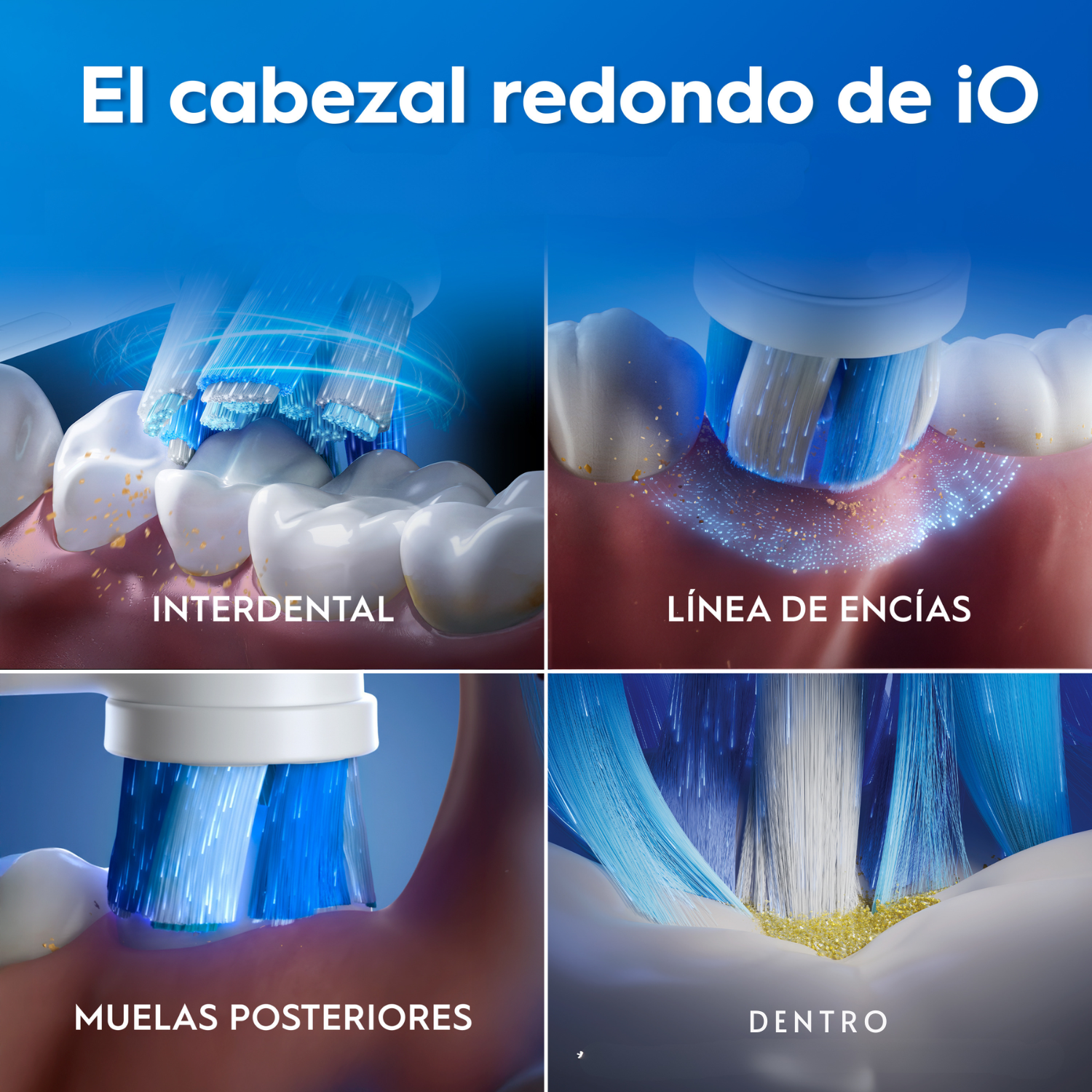 El cabezal redondo de iO. Interdental. Línea de encías. Muelas posteriores. Dentro.