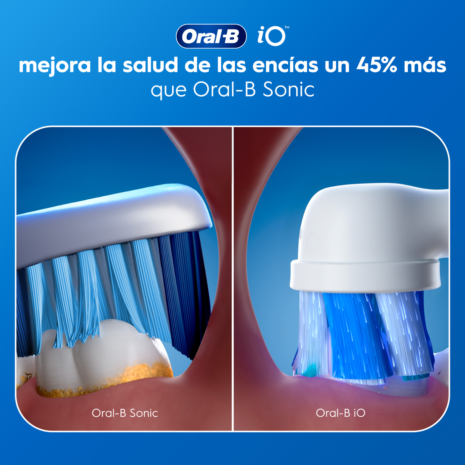 Oral-B iO mejora la salud de las encías un 45% más que Oral-B Sonic. Comparativa imagen: Oral-B iO. Oral-B Sonic.